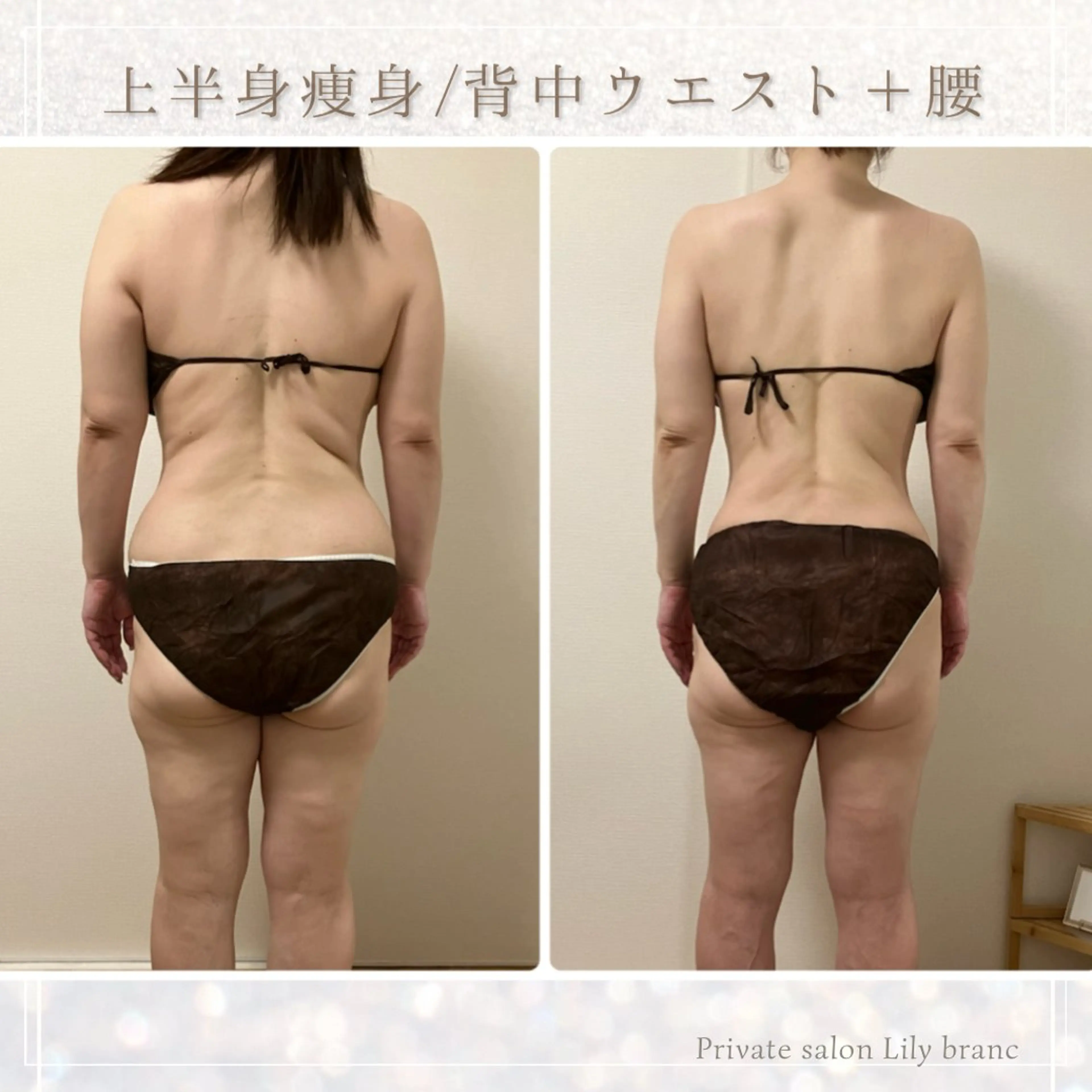 Lily branc 痩身/小顔/肌質改善のエステ・リラクイメージ