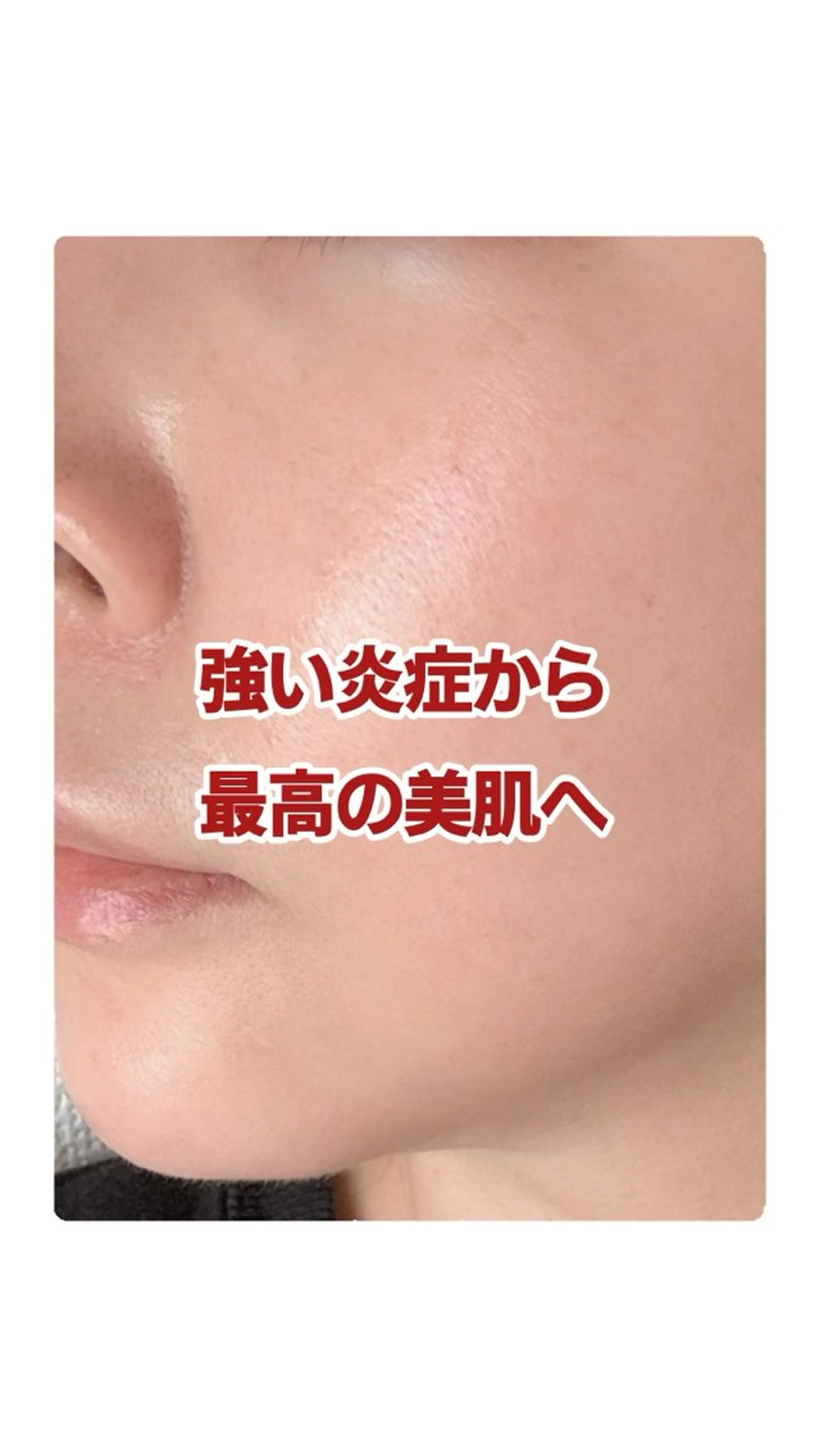 エステ リラク グリーンピール専門店 サロンY【大阪】のエステ・リラクイメージ