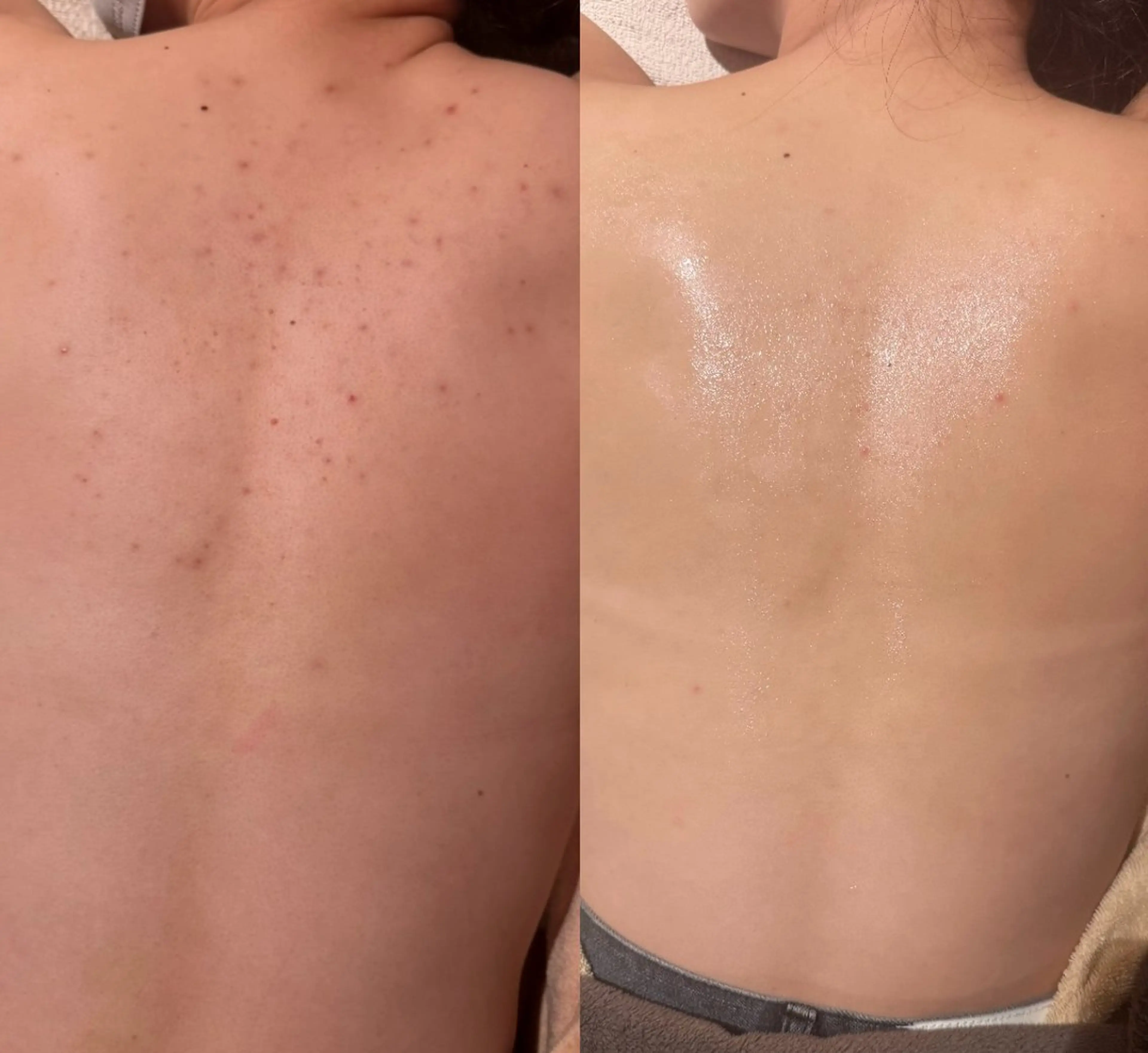 エステ for woman所属・森 美優のエステ・リラクイメージ