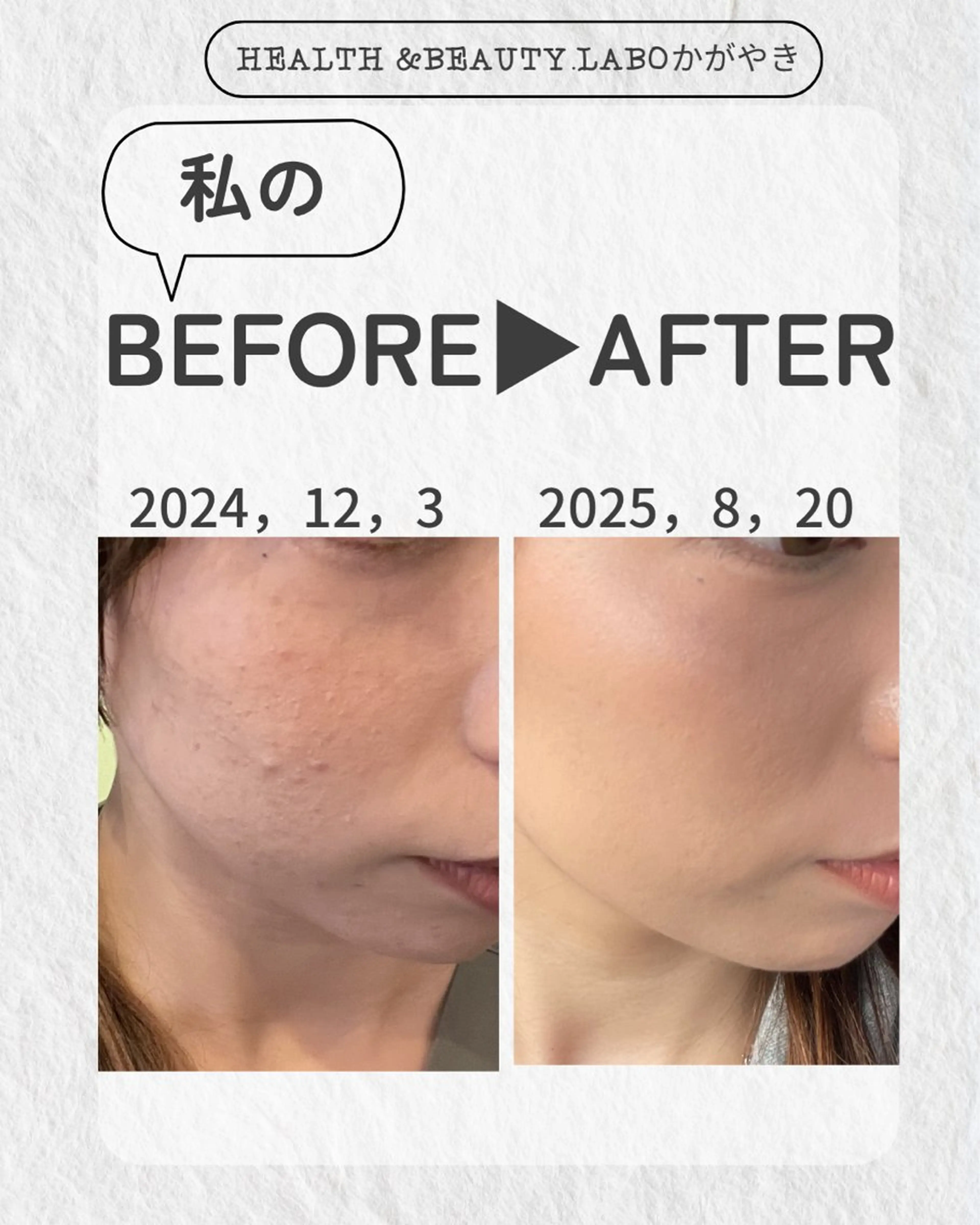 リラク Health&Beauty.Laboかがやき所属・髙村 安里のエステ・リラクイメージ