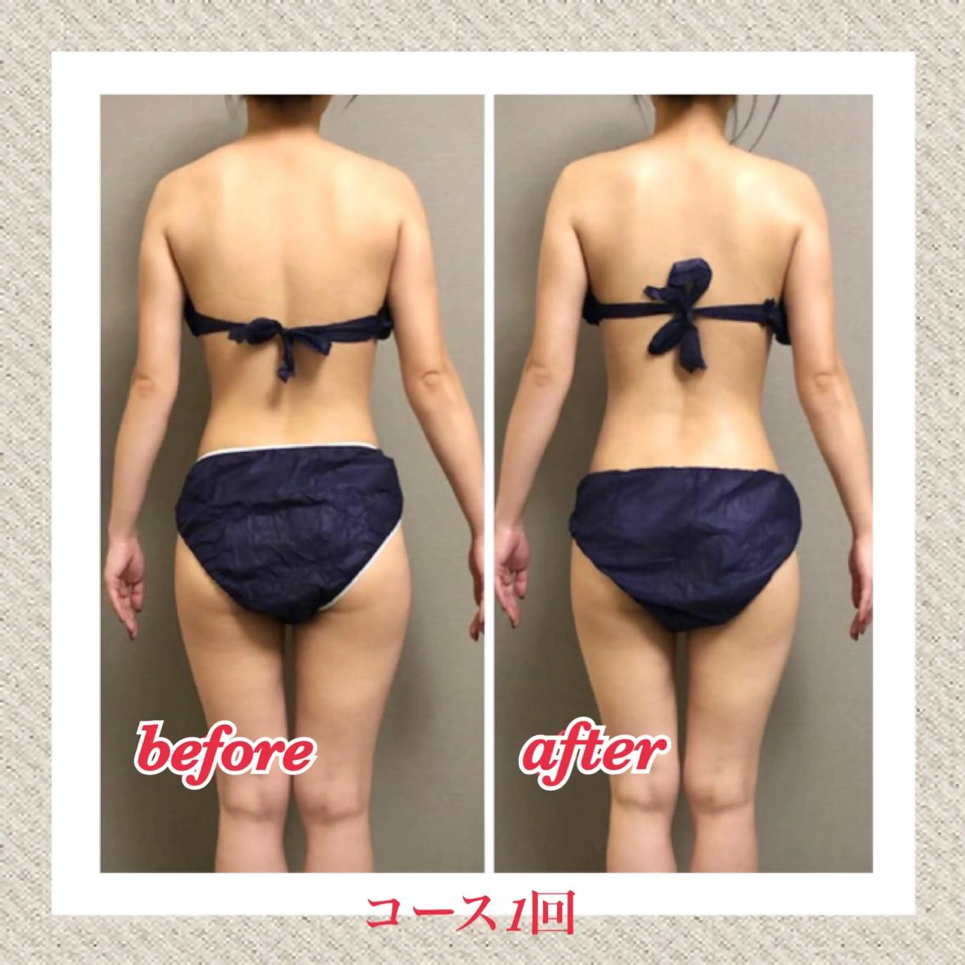 エステ 美ola ビオラのエステ・リラクイメージ