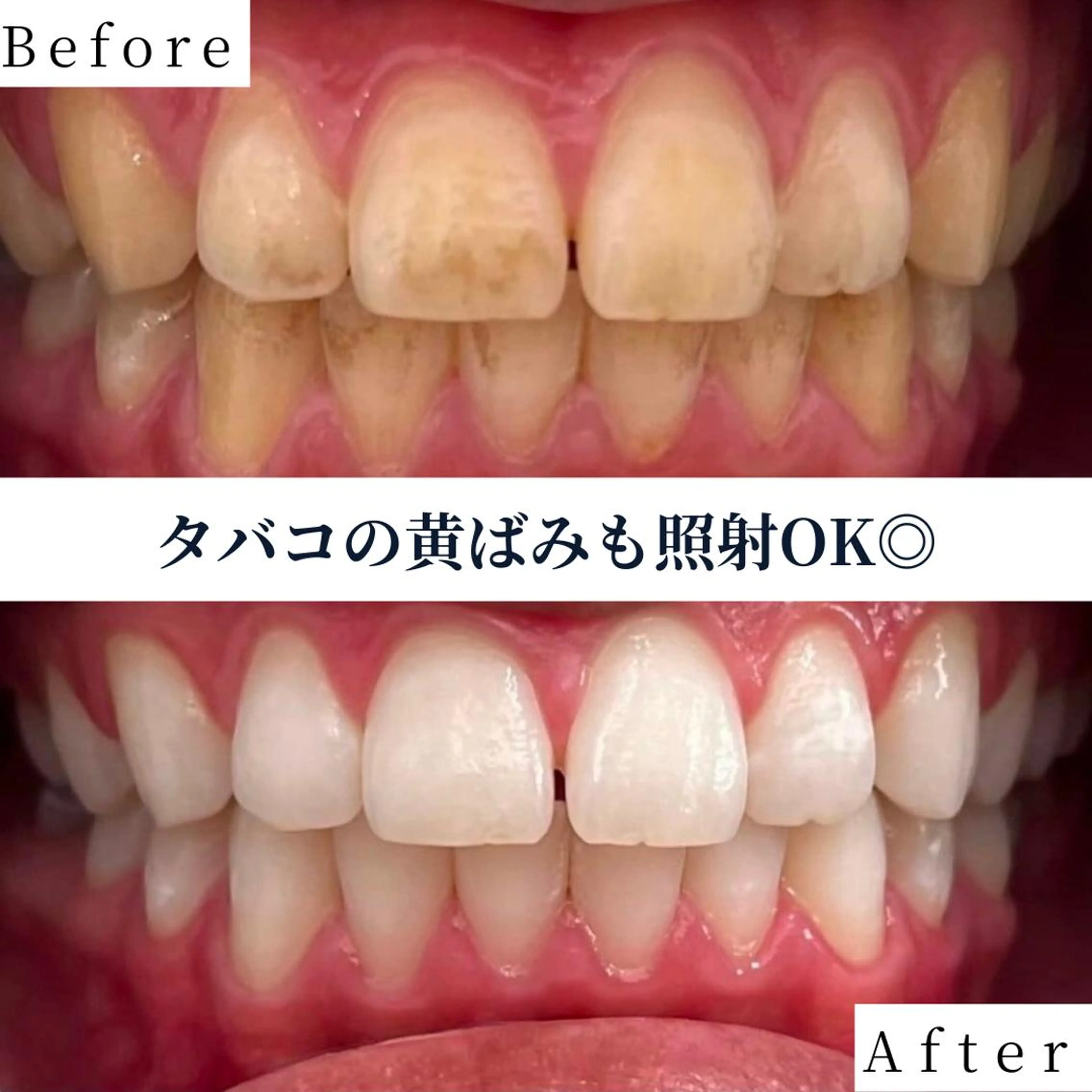 ホワイトニング ショップ茨木店/増田のその他イメージ