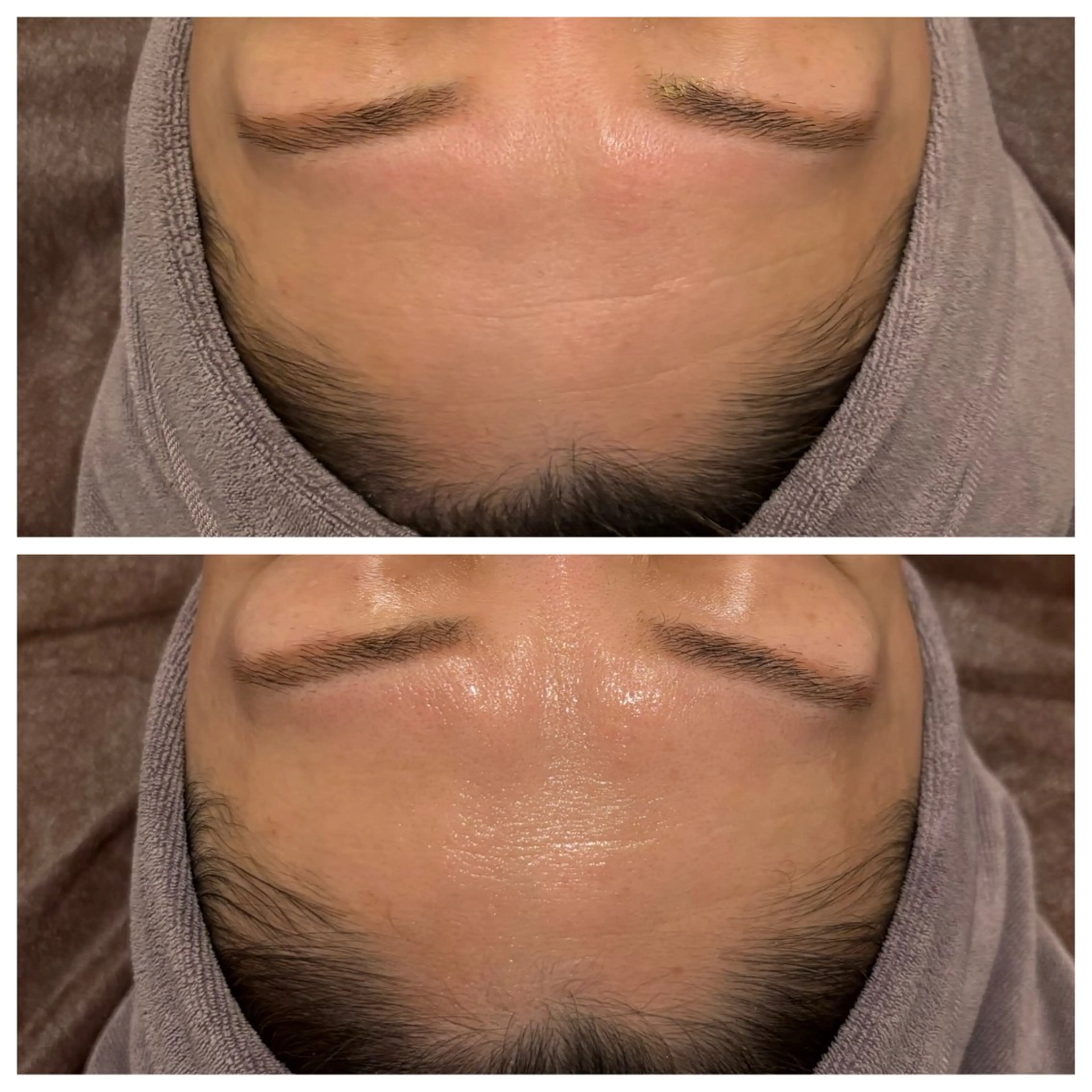 ☆痩身/小顔☆ コルギのエステ・リラクイメージ