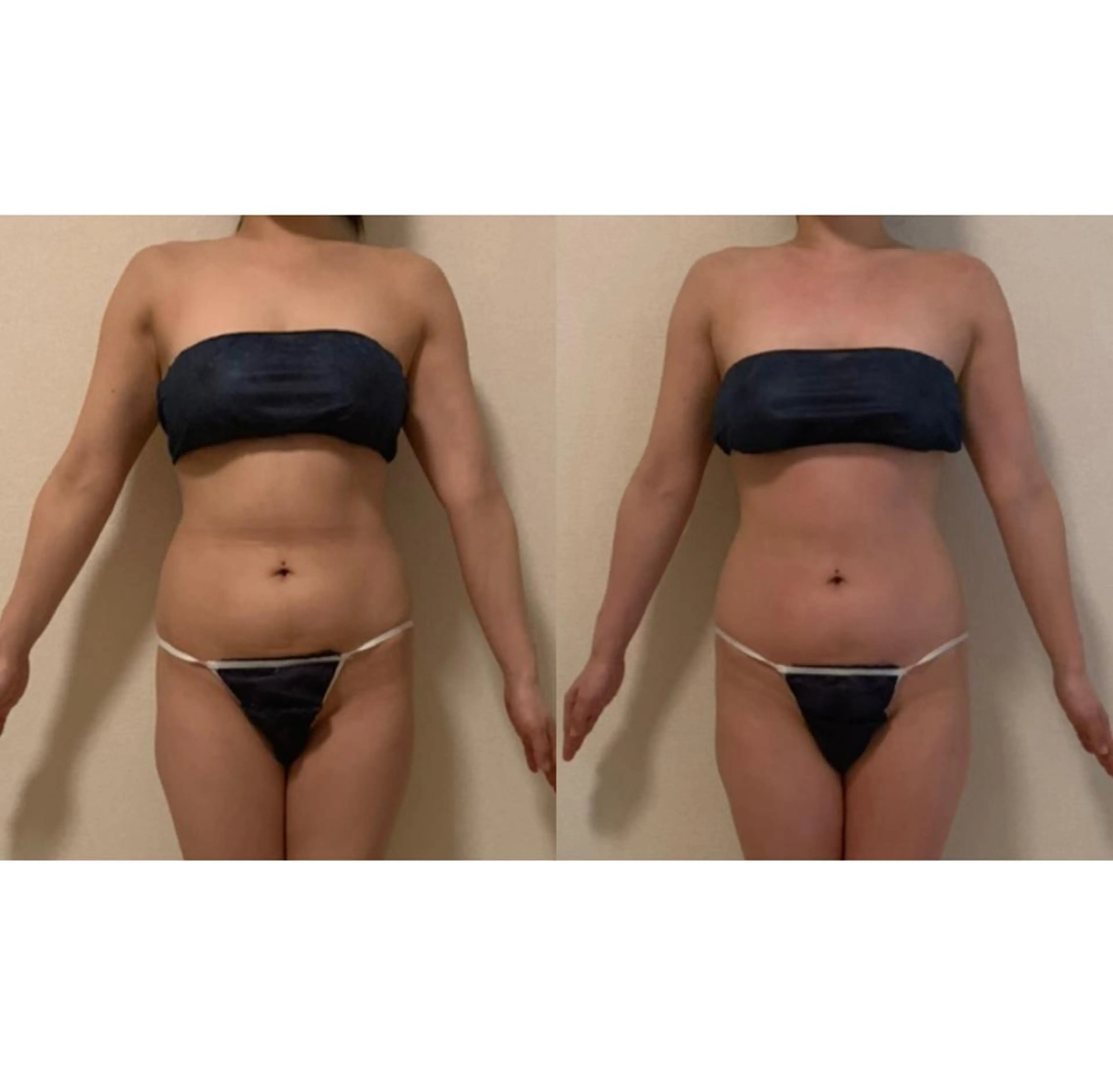 a  room salonのエステ・リラクイメージ