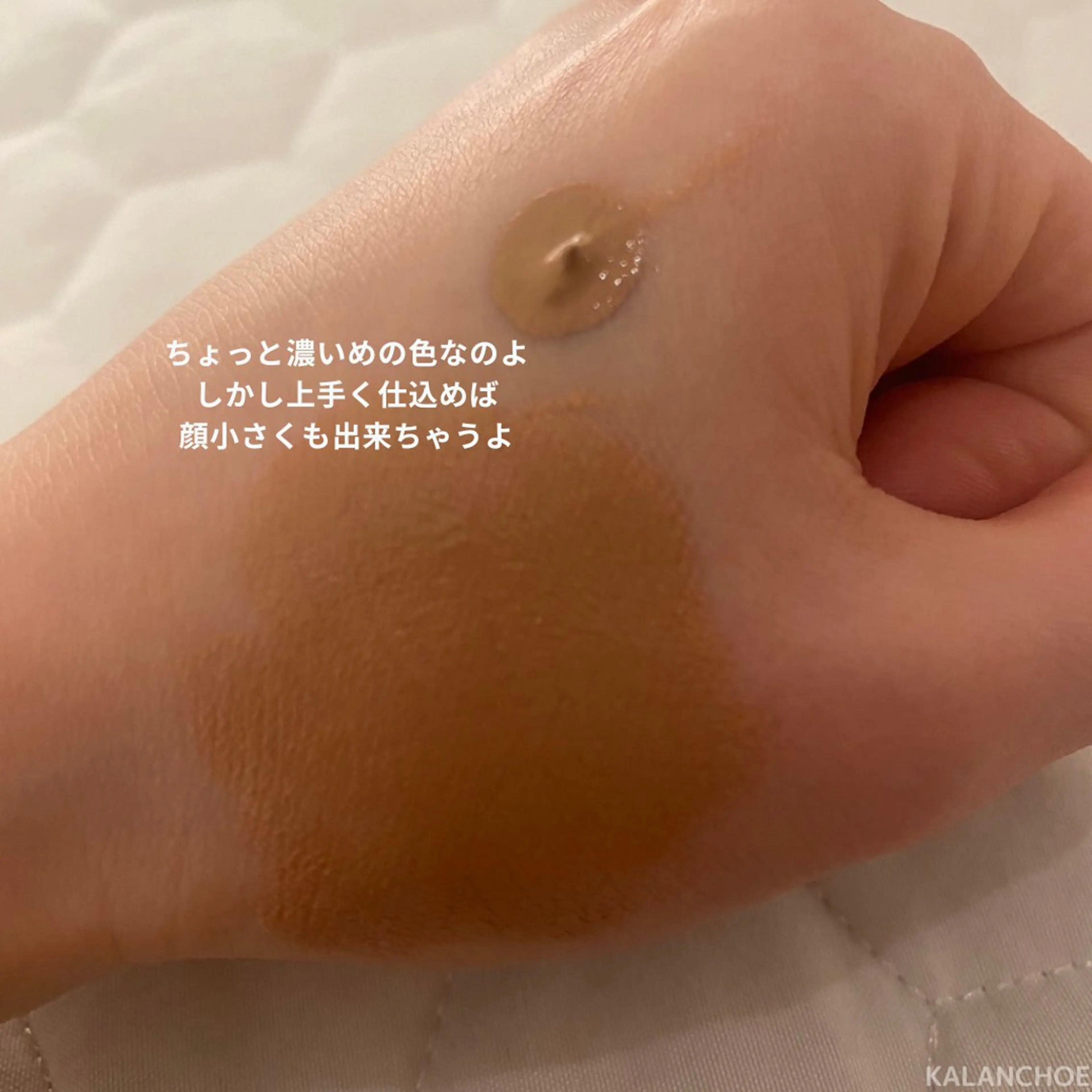 エステ 肌質改善 KALANCHOEのエステ・リラクイメージ