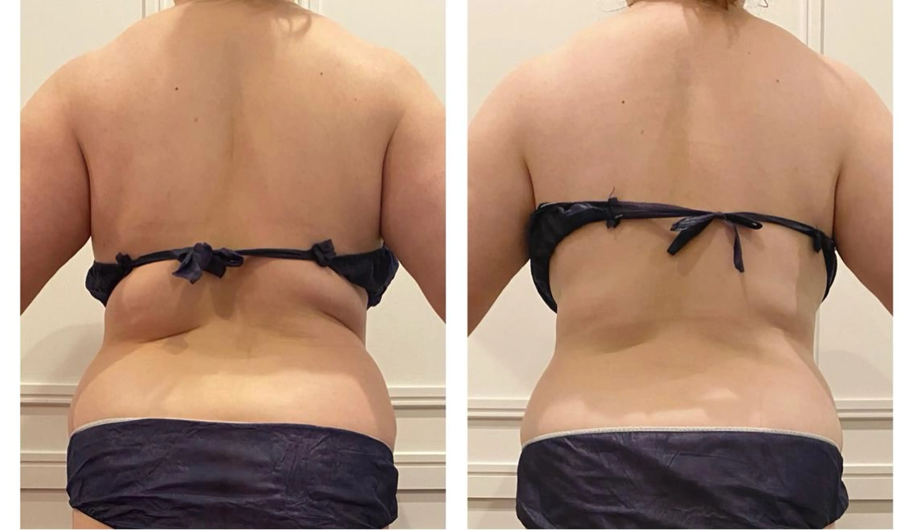 通うほど変わる本格 エステ心斎橋REVIのエステ・リラクイメージ