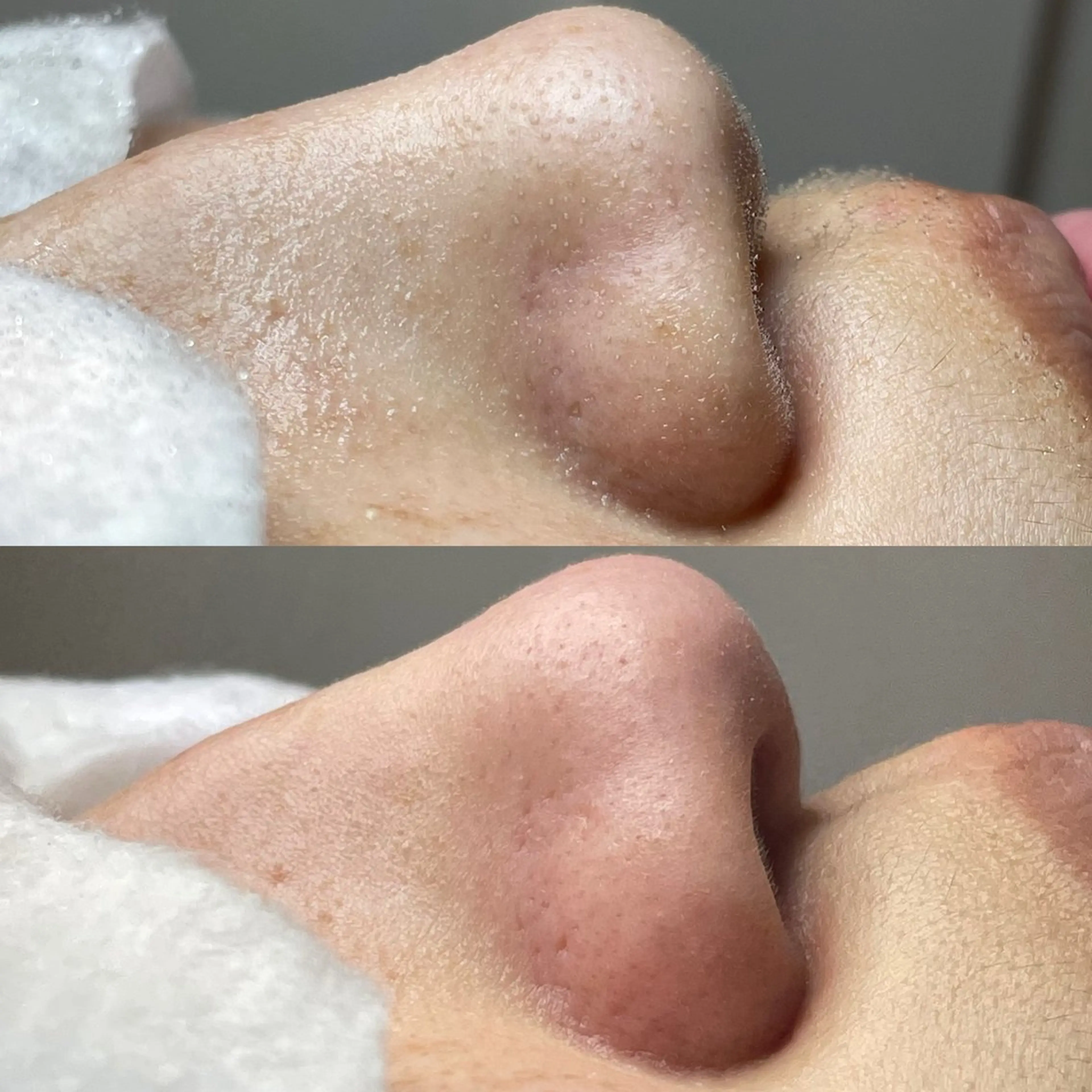 エステ リラク セルフエステエンリケ明石大久保店所属・夕希リンパ&痩身& 脱毛&毛穴ケアのエステ・リラクイメージ