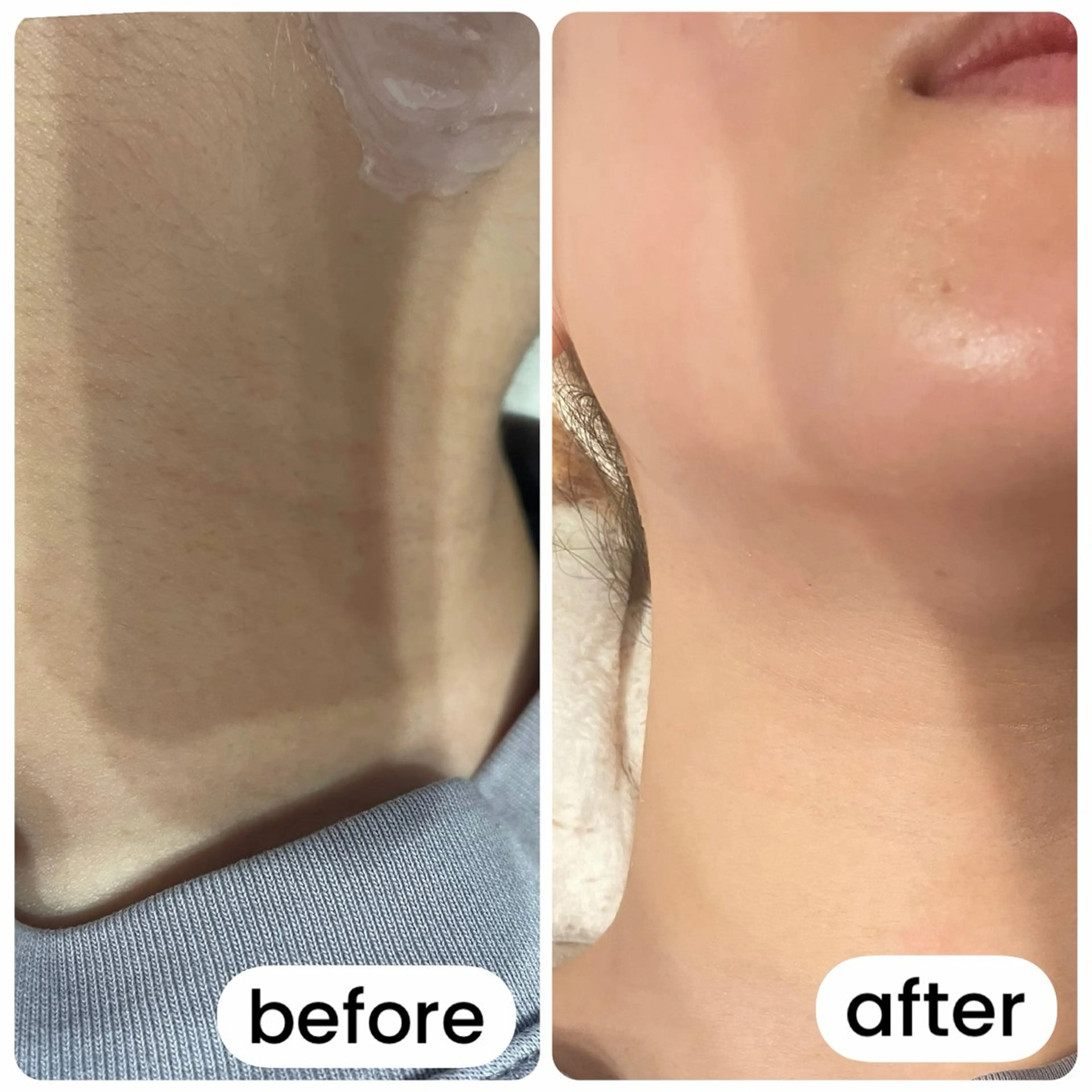 エステ Fuwari Momiのエステ・リラクイメージ