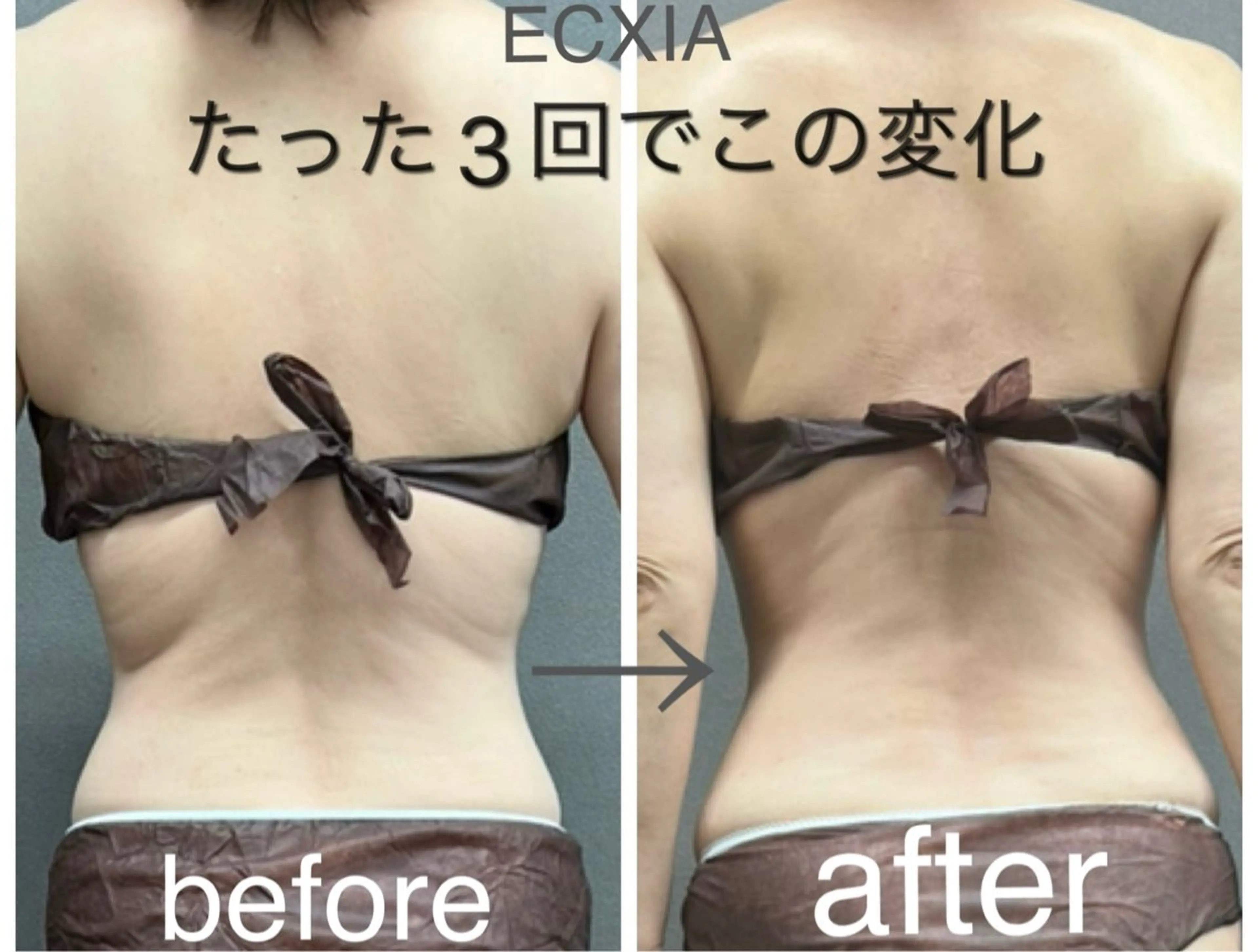 エステ リラク ECXIA 【エクシア】のエステ・リラクイメージ