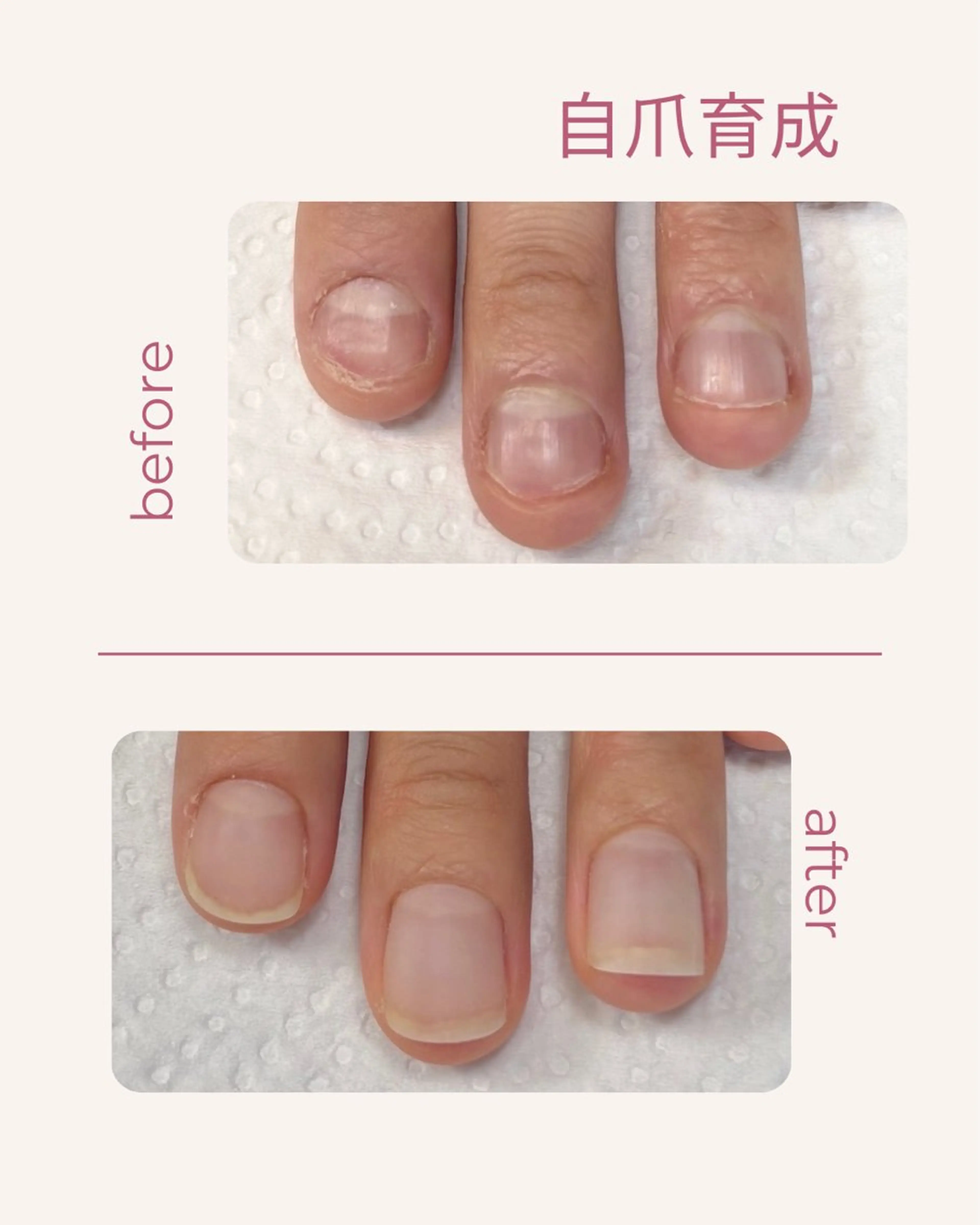 ネイル 自爪育成 Keshlyのネイルデザイン