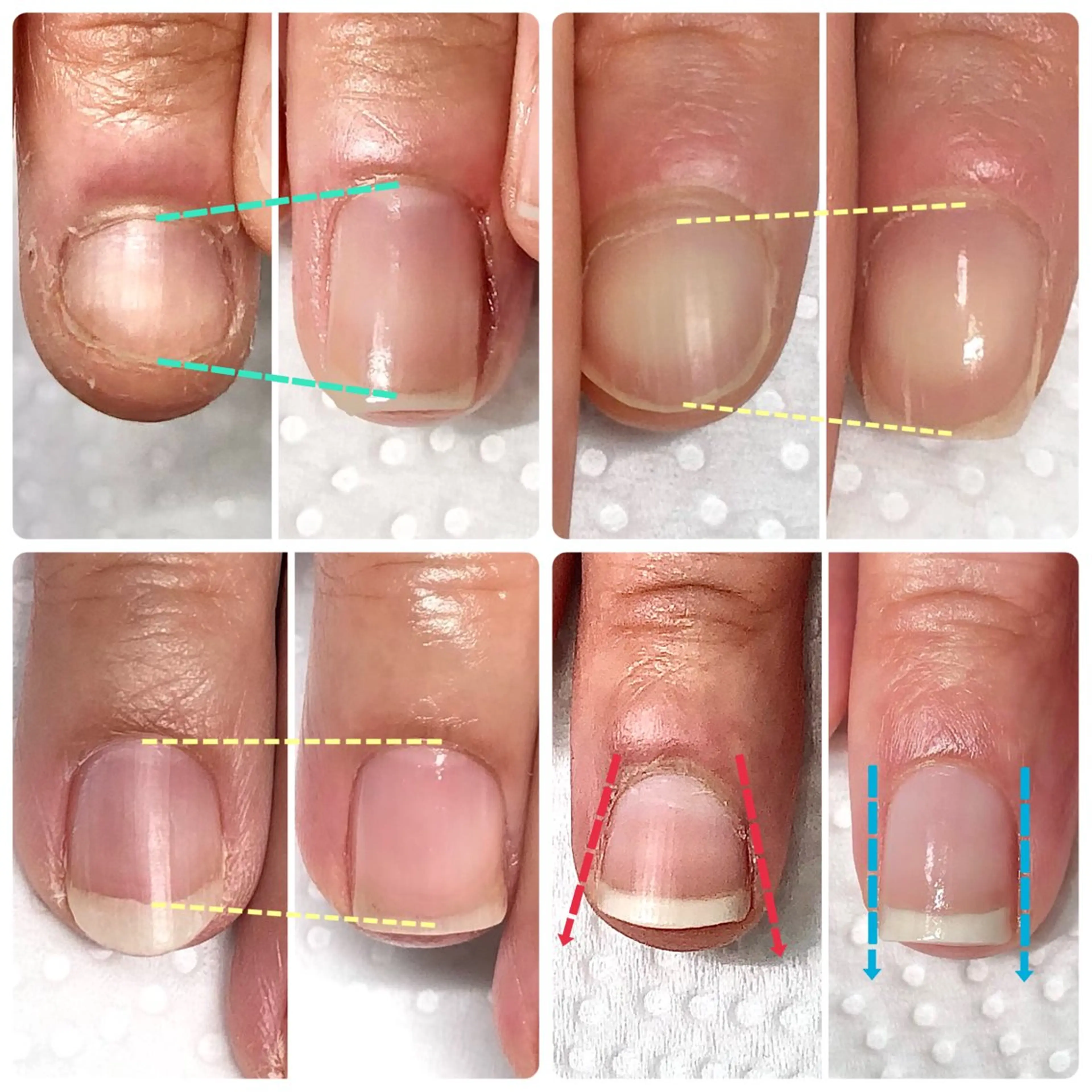 あと1名！ジェルを載せない3ヶ月の自爪育成コース🍀😊サロン施術10回分＋カウンセリング＋ホームケア用品込の写真