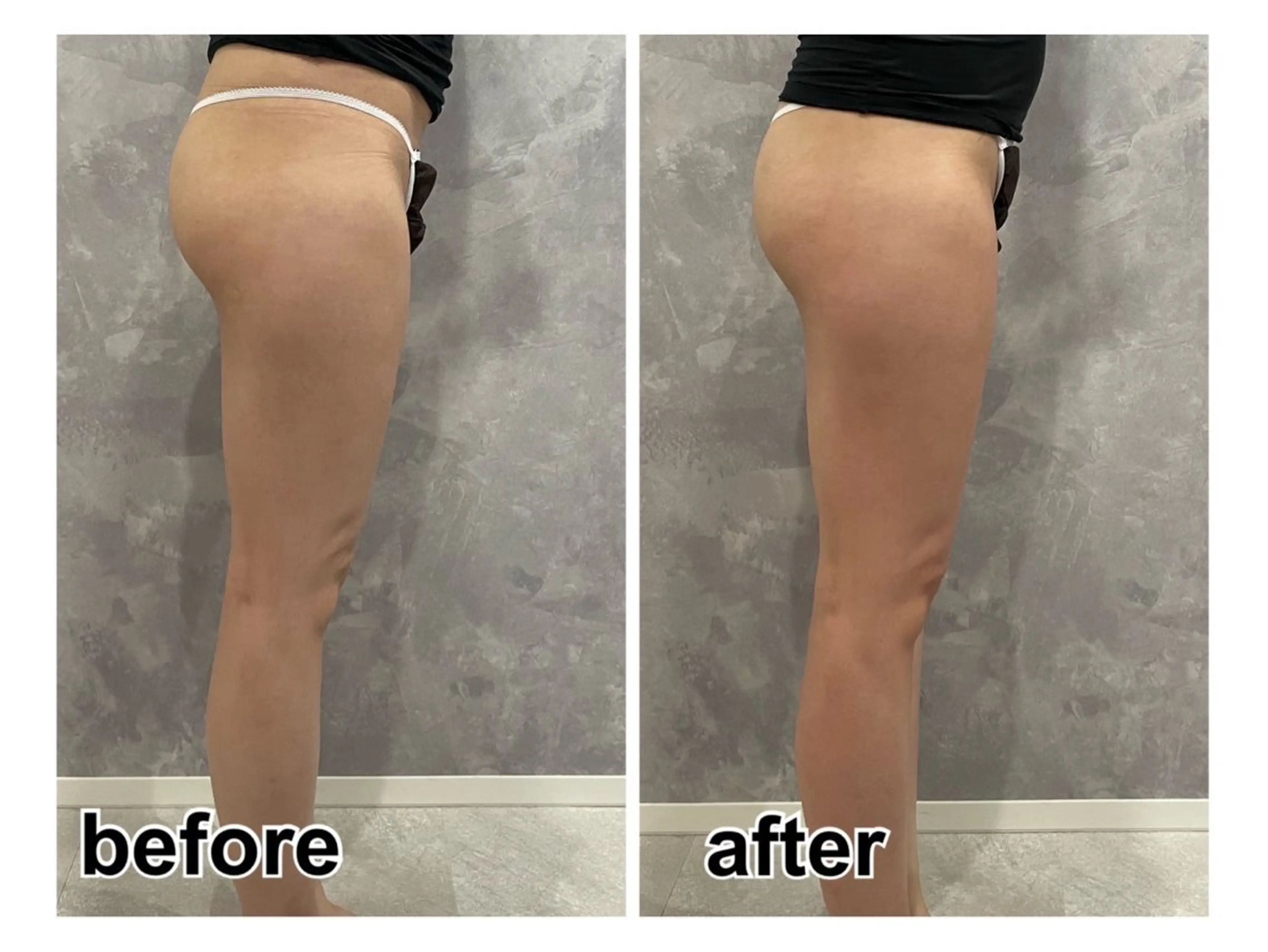 リラク 林 陽向のエステ・リラクイメージ