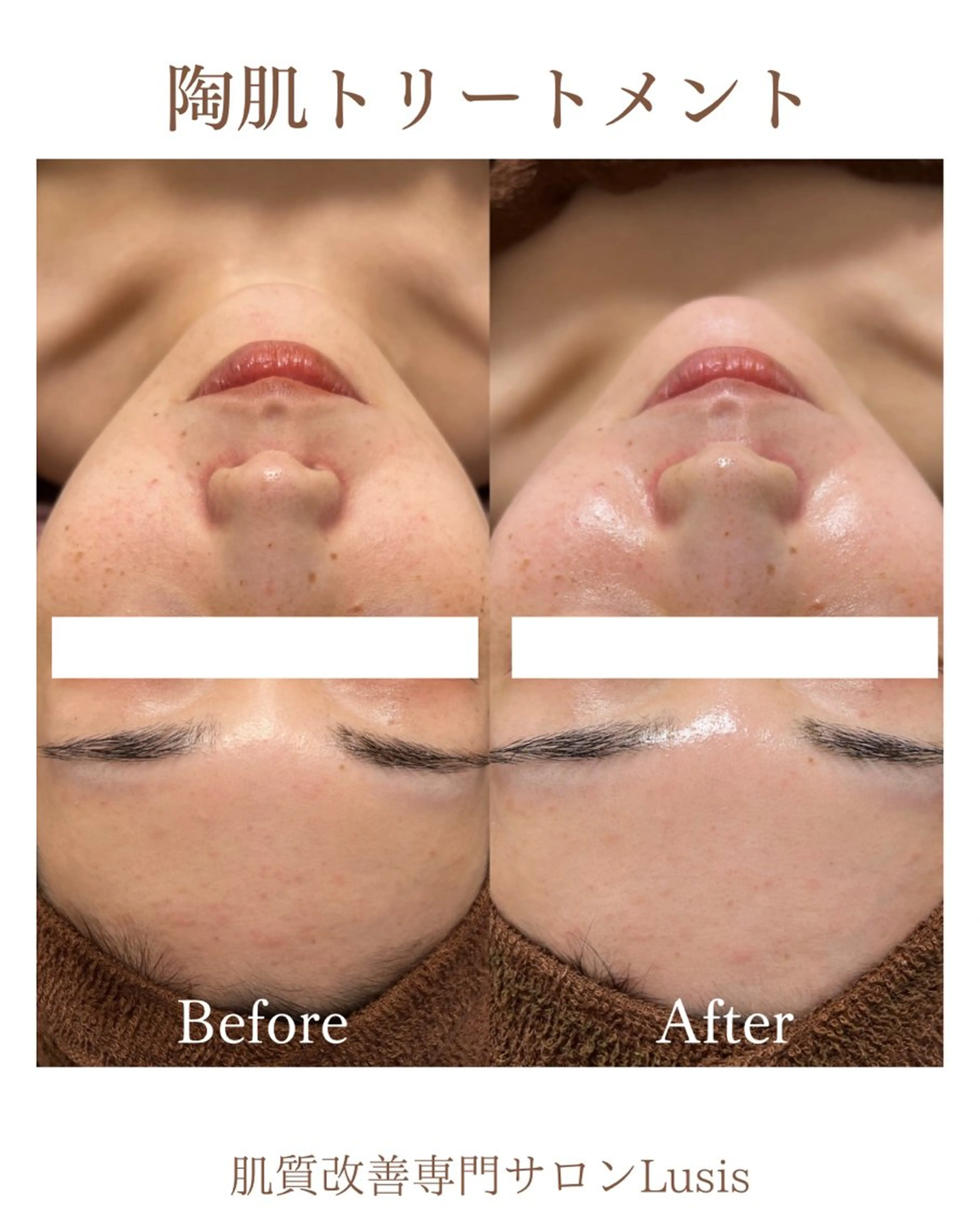 エステ フェイシャルサロンLusis所属・肌質改善専門サロン Lusisのエステ・リラクイメージ