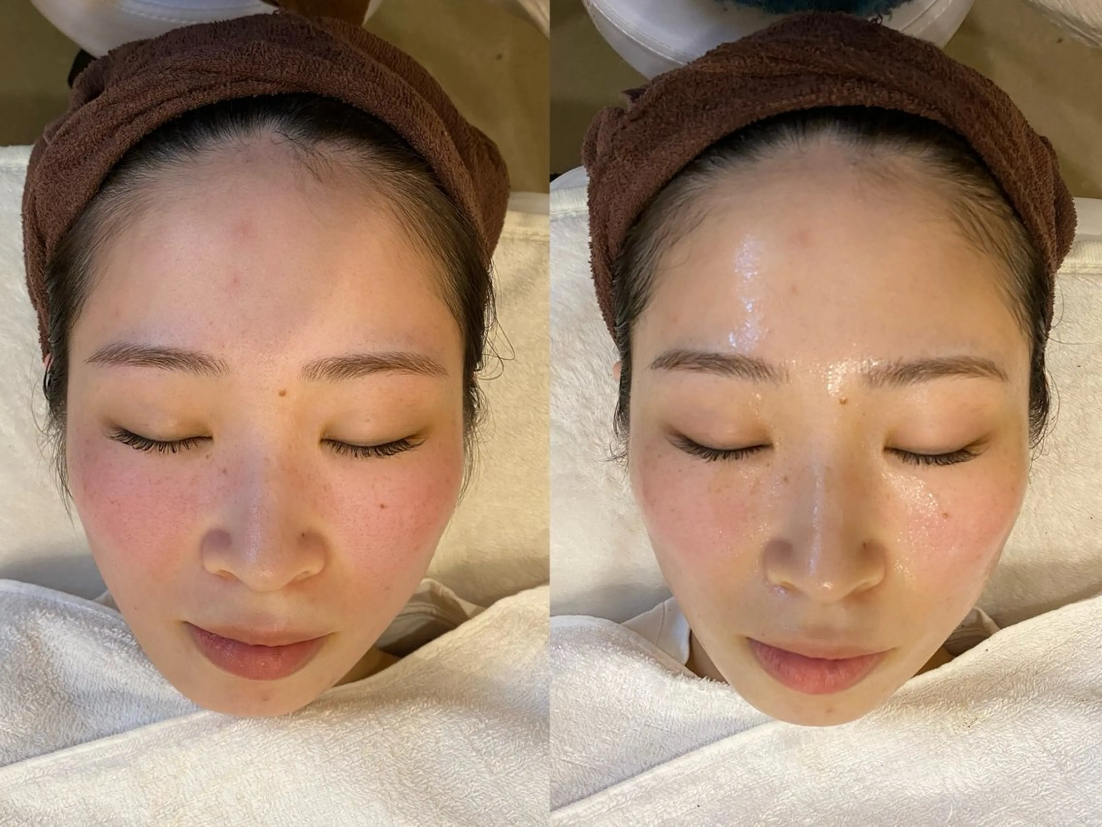 ハーブピーリング🌿 脱毛🧡ヘッドスパのエステ・リラクイメージ