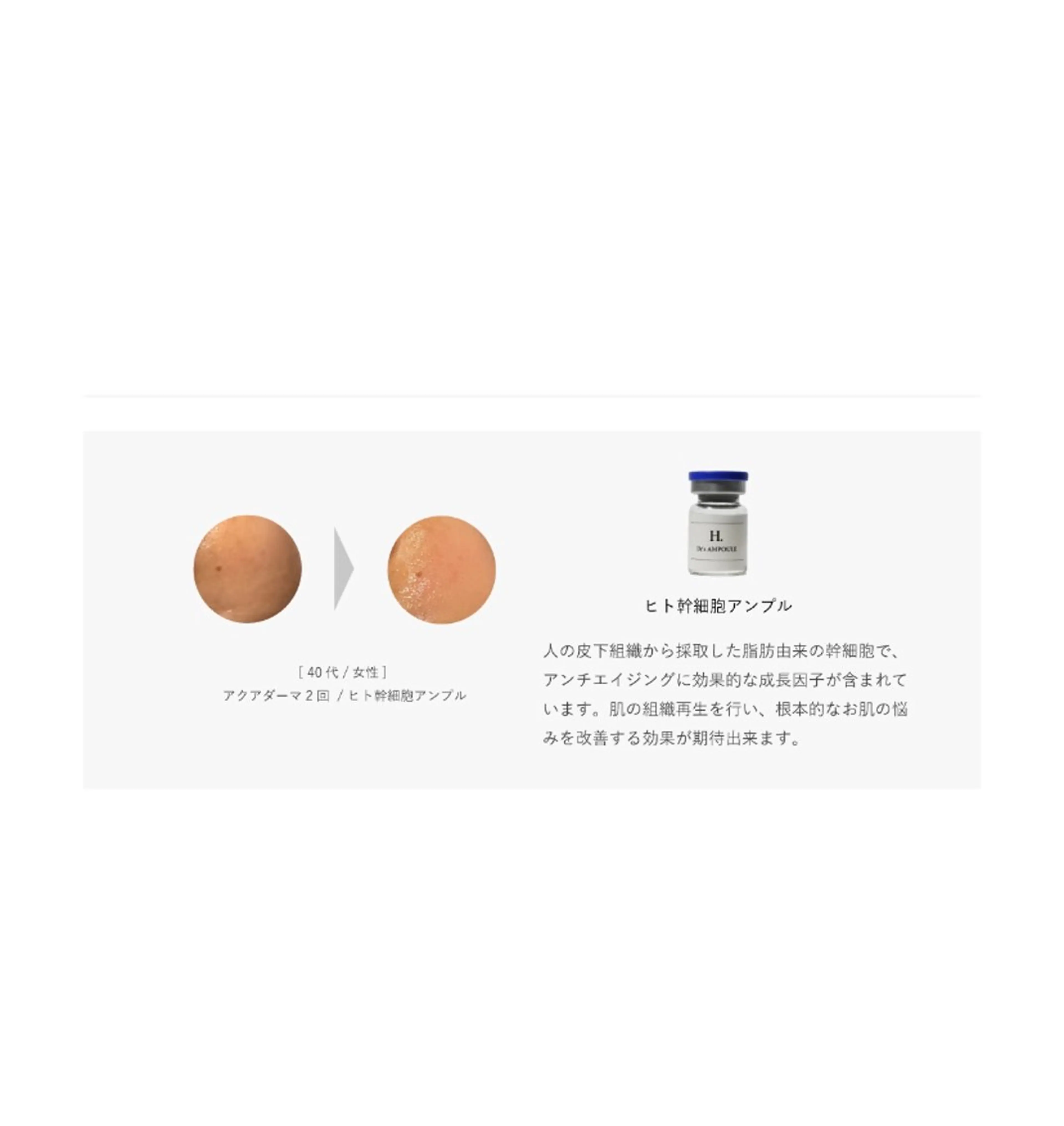 💐美肌/小顔づくり 🫧看護師🫧ASAのエステ・リラクイメージ