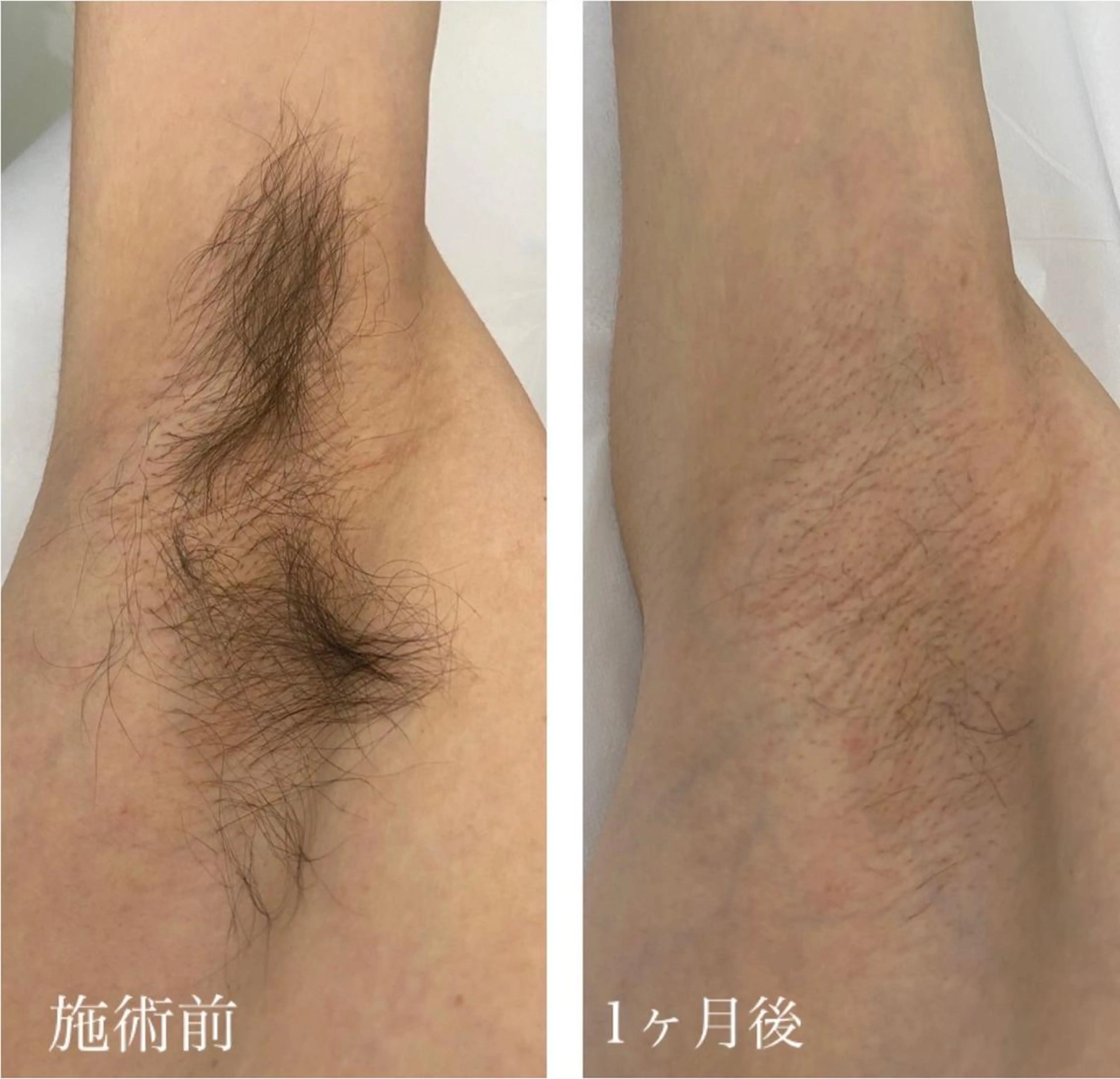 Mignon +所属・Mignon + Natsukiのマツエク・マツパデザイン