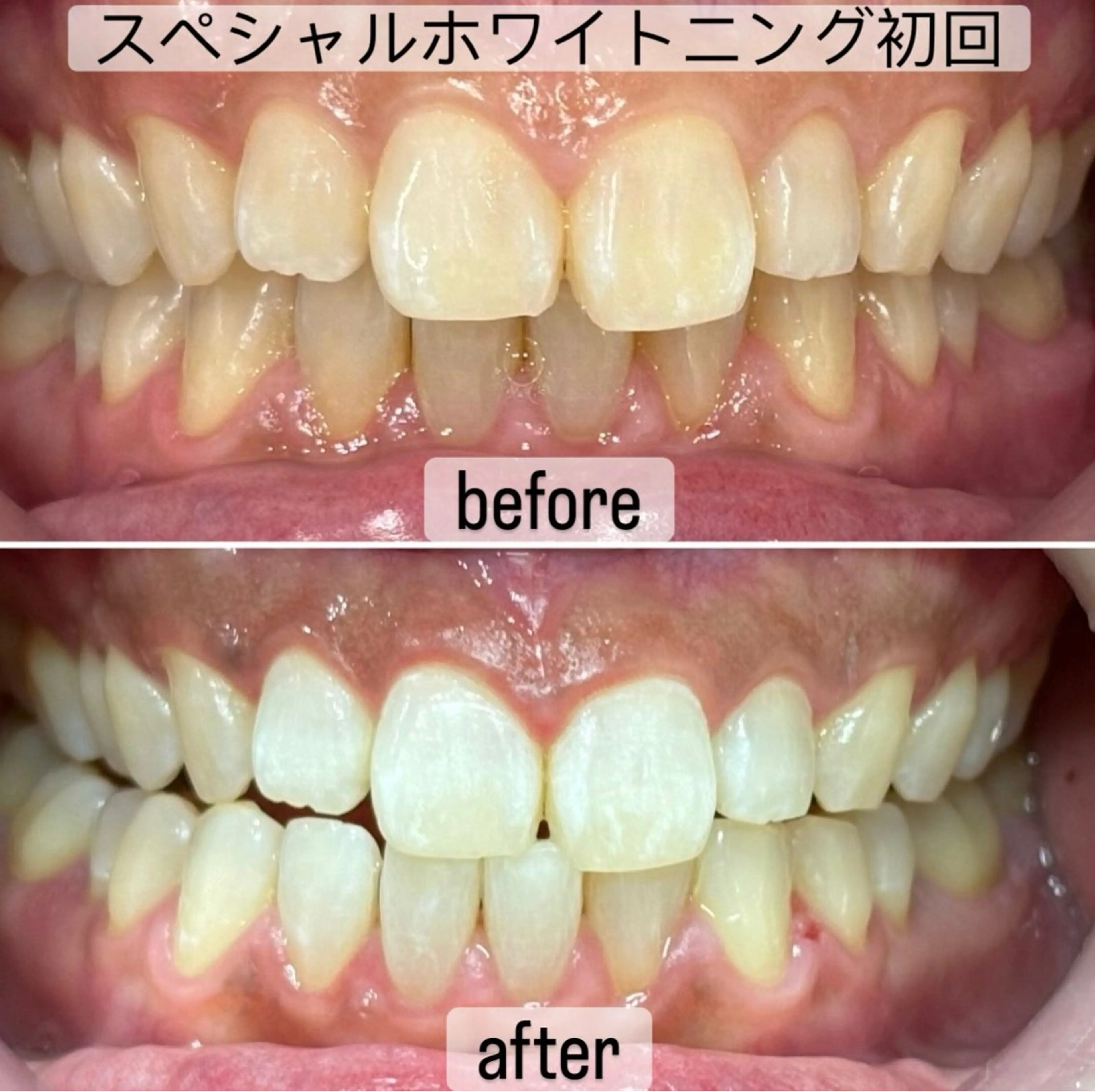 【新規限定】春に向けて今だけの特別限定価格！の写真