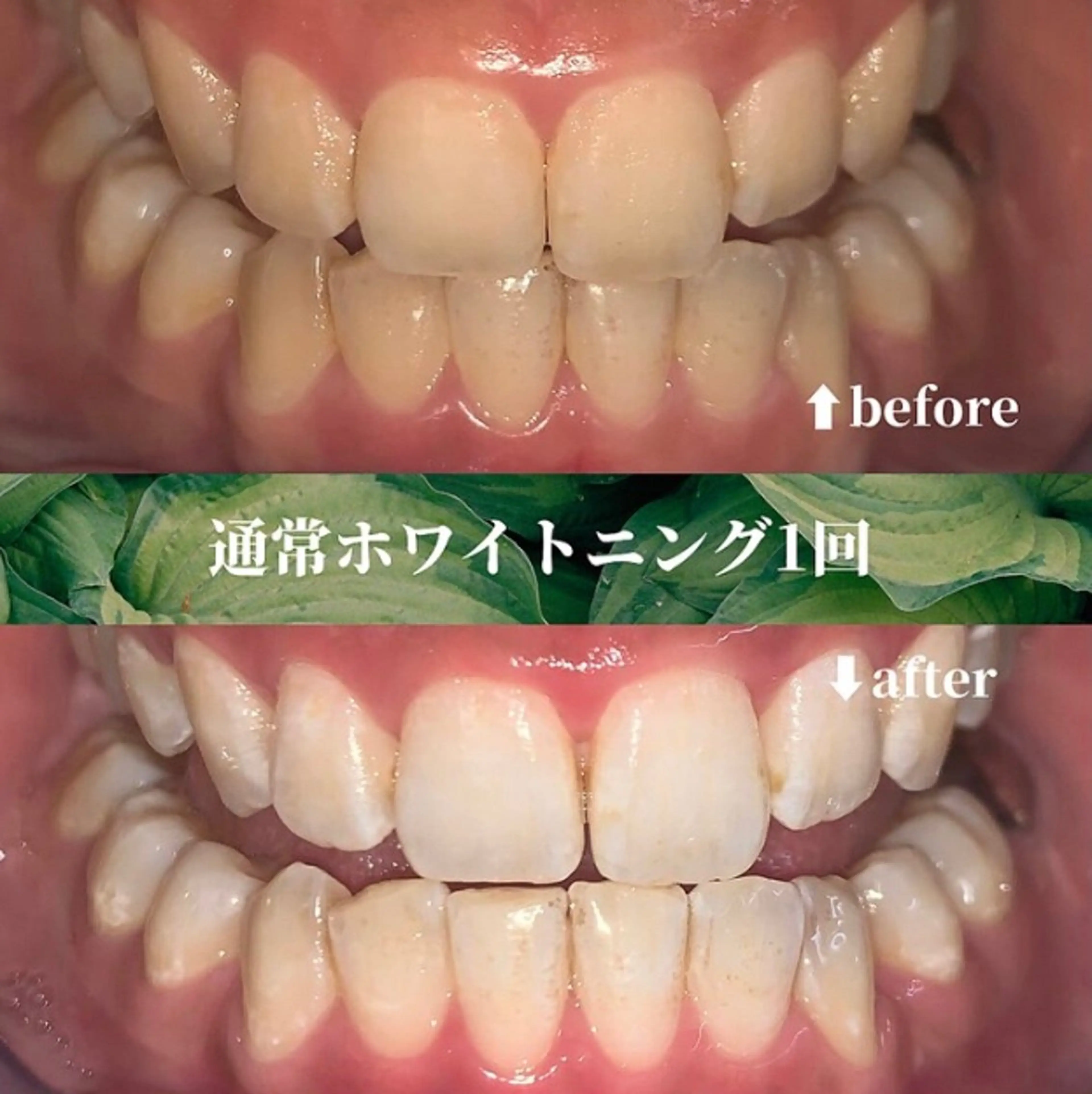 futaba ホワイトニング/天神のエステ・リラクイメージ