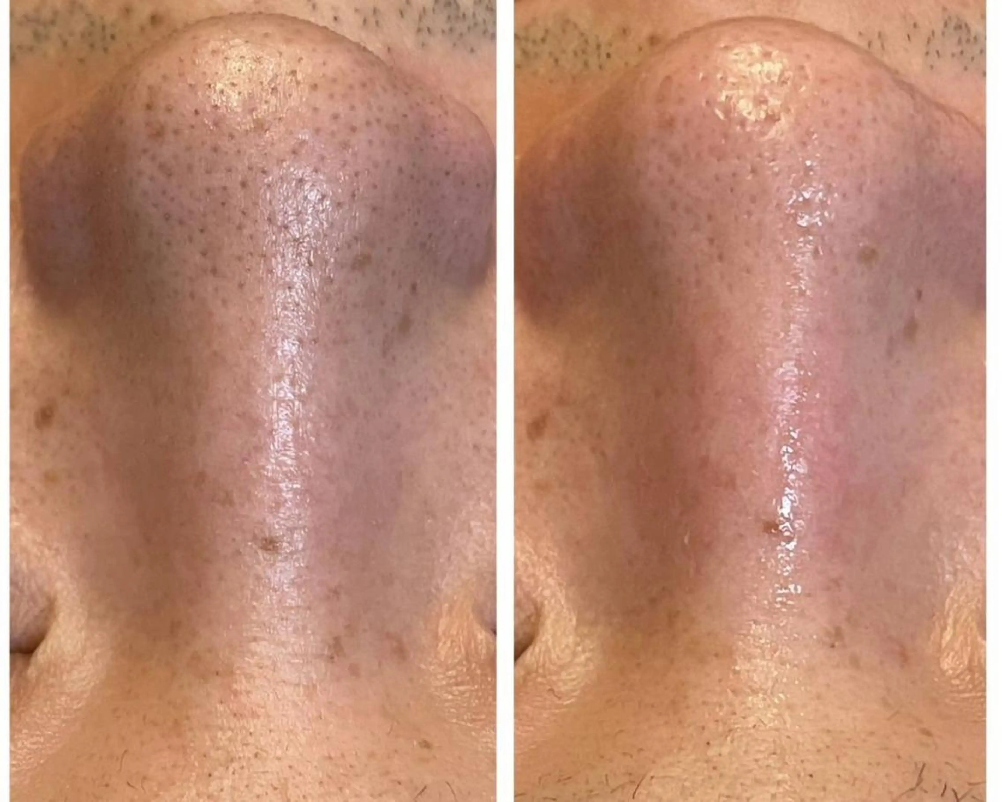 その他 脱毛×肌管理サロン ルネルのエステ・リラクイメージ