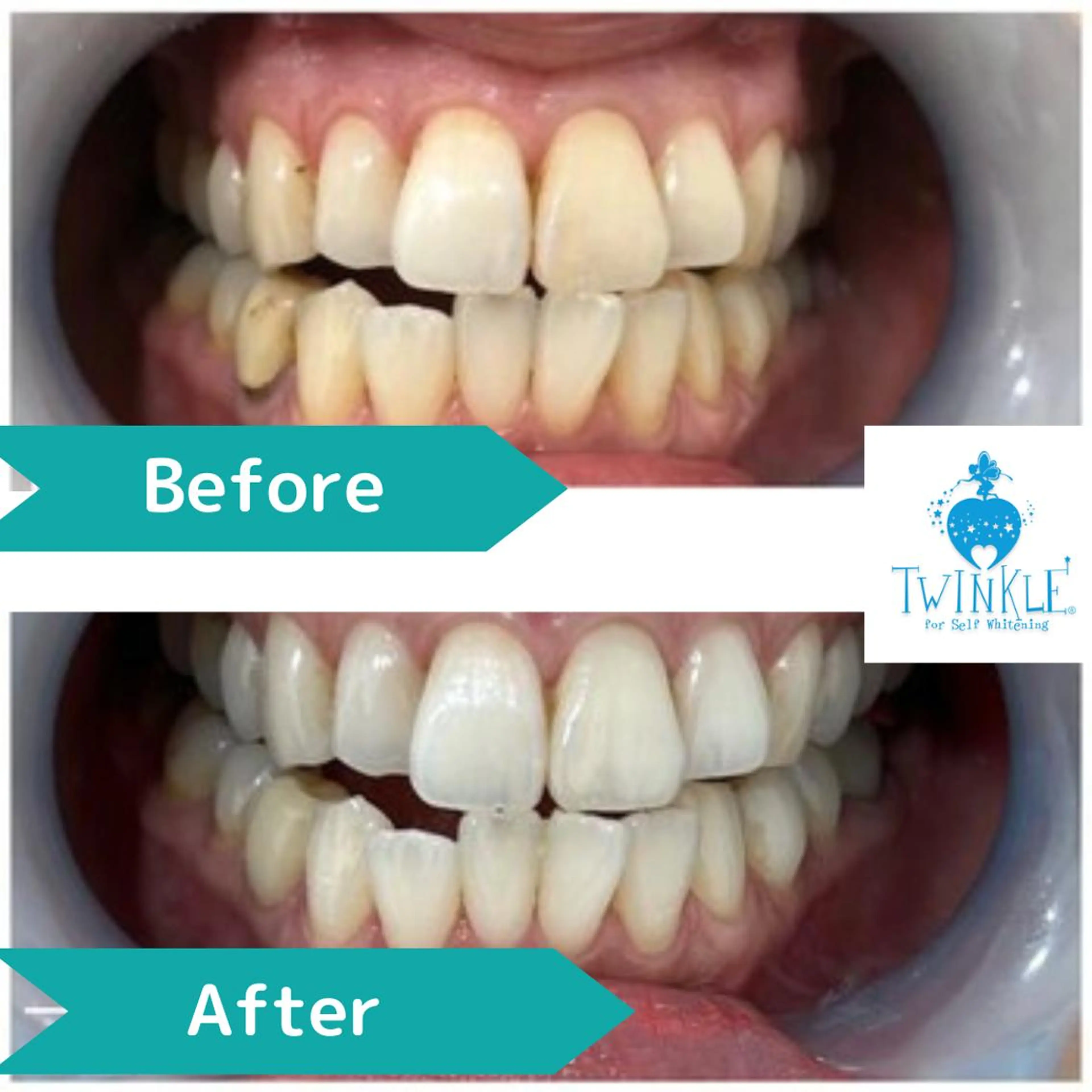 Twinkle White上尾店のエステ・リラクイメージ