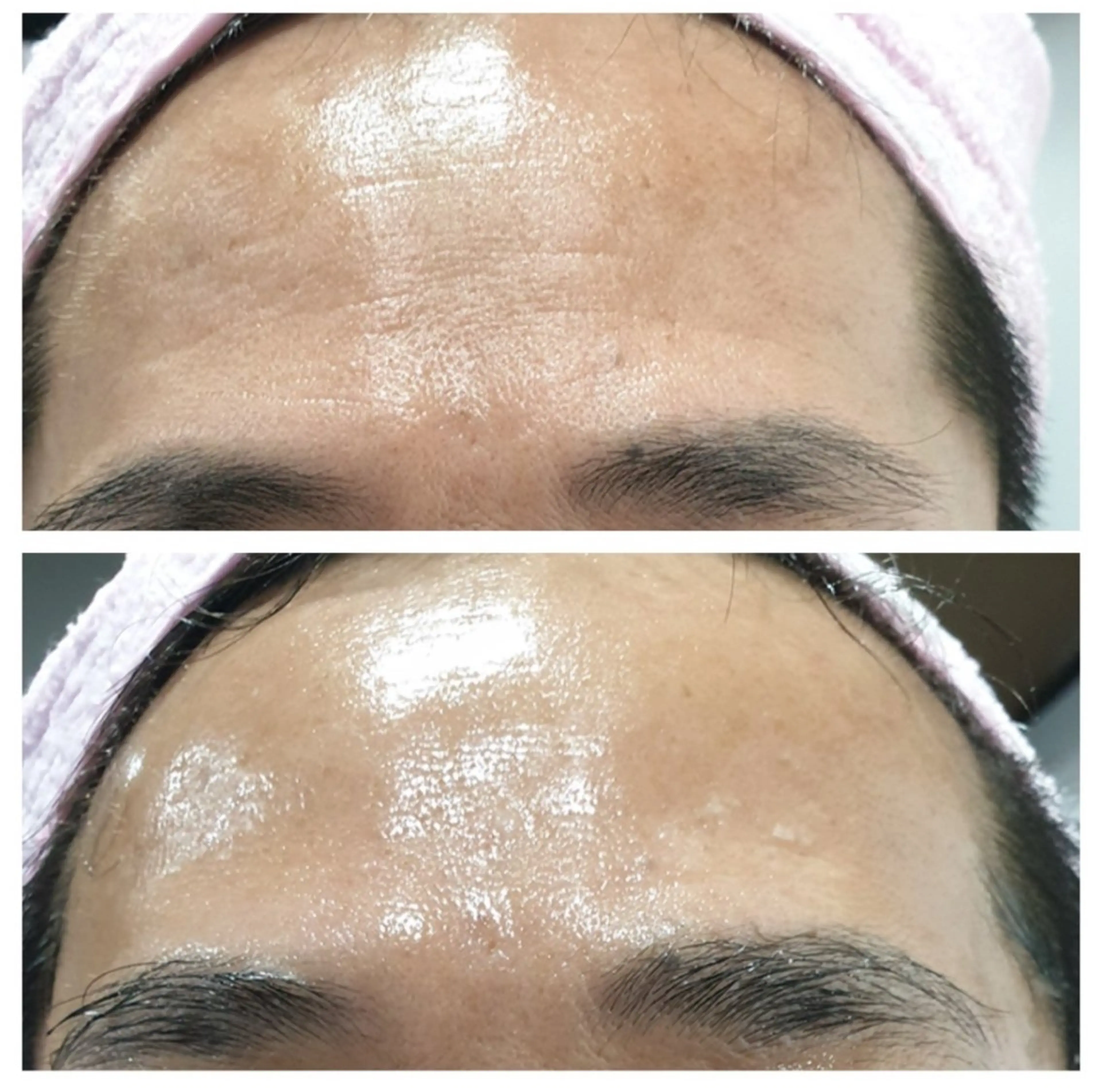 肌育専門ナース❗️ みのり／ナスサロのエステ・リラクイメージ