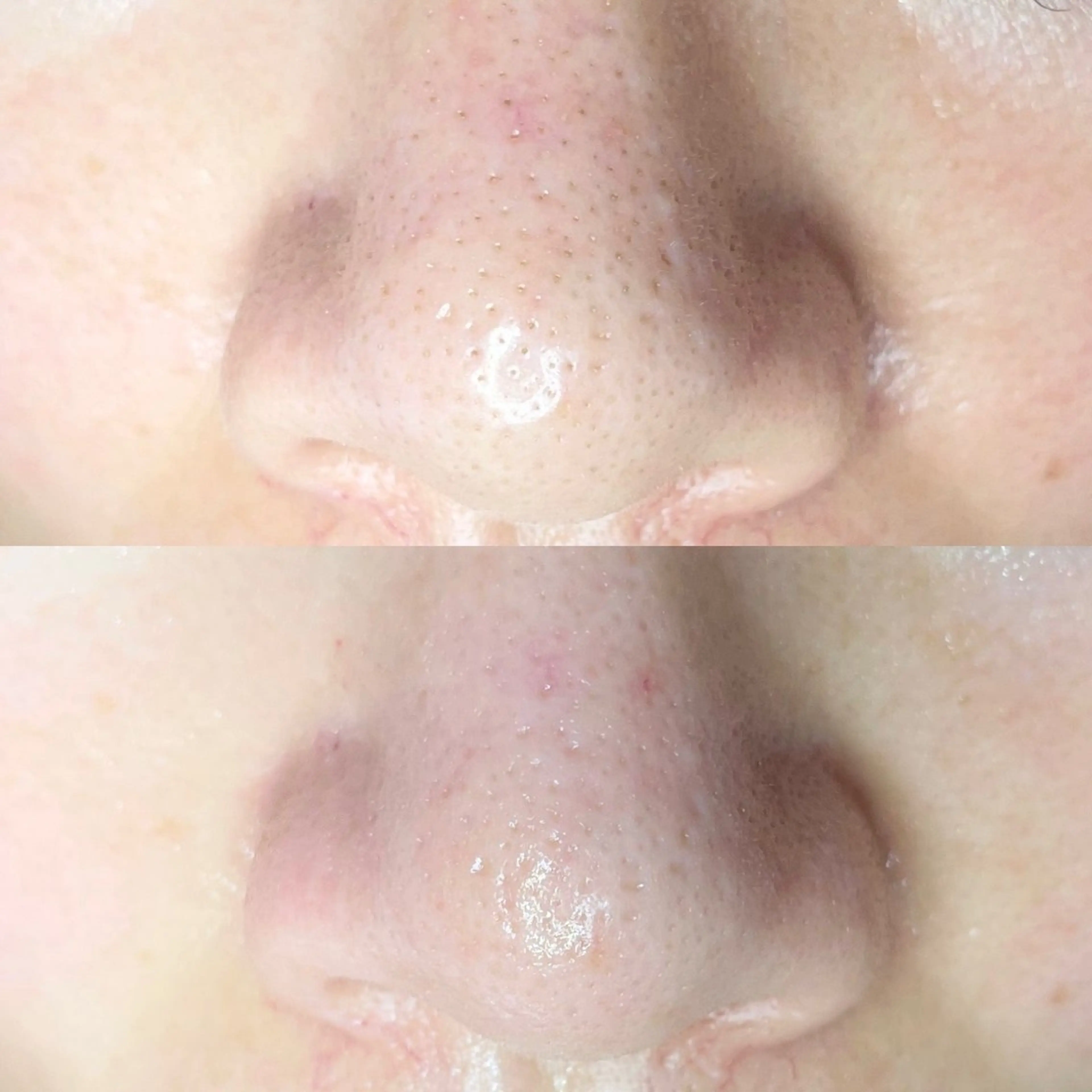 毛穴専門店MeMe.八千代店所属・\毛穴・頭皮/ のお悩みに特化💪のその他イメージ