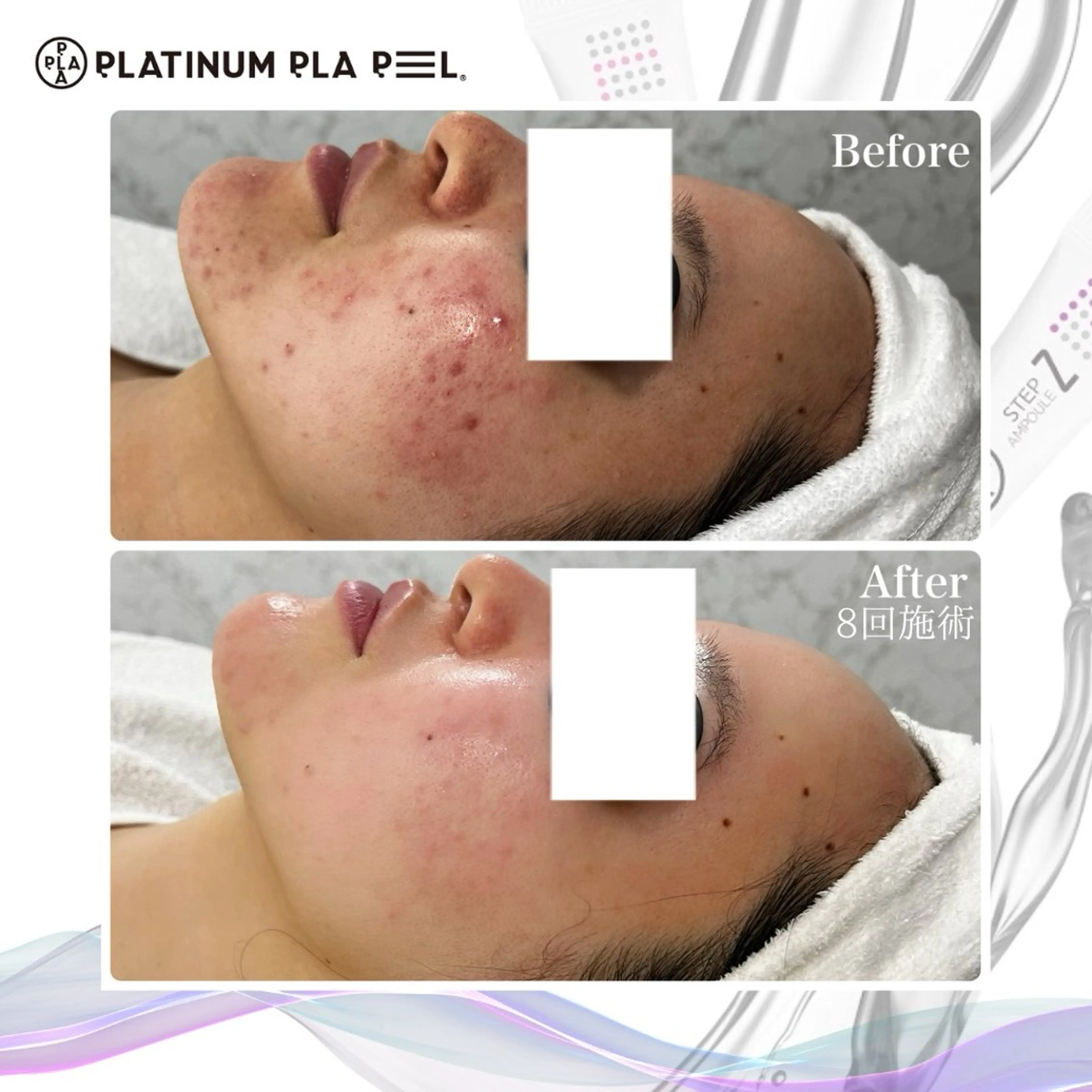 エステ Liam《美肌管理/ 3D小顔/脂肪ケア》のエステ・リラクイメージ