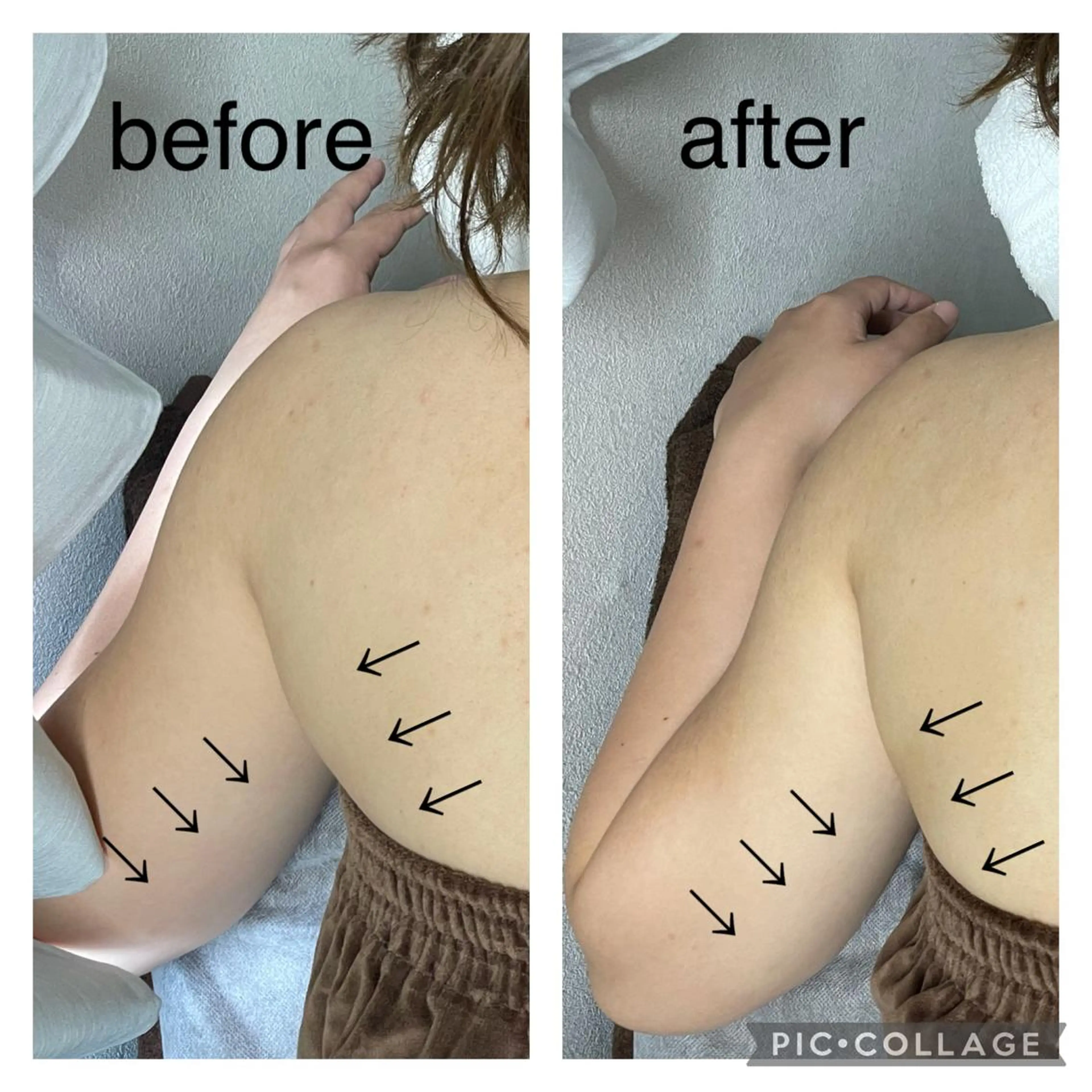 エステ ENCHANT 脱毛.小顔.毛穴のエステ・リラクイメージ