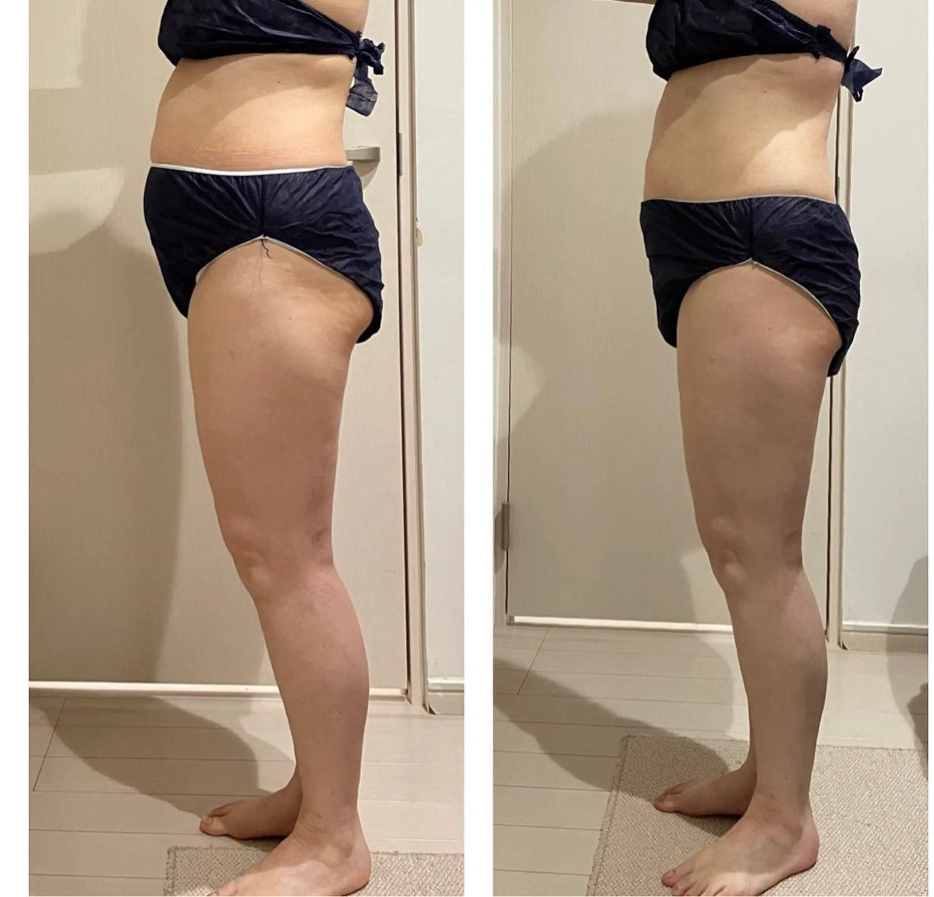 kirara所属・温活痩身美肌エステ サロンkiraraのエステ・リラクイメージ