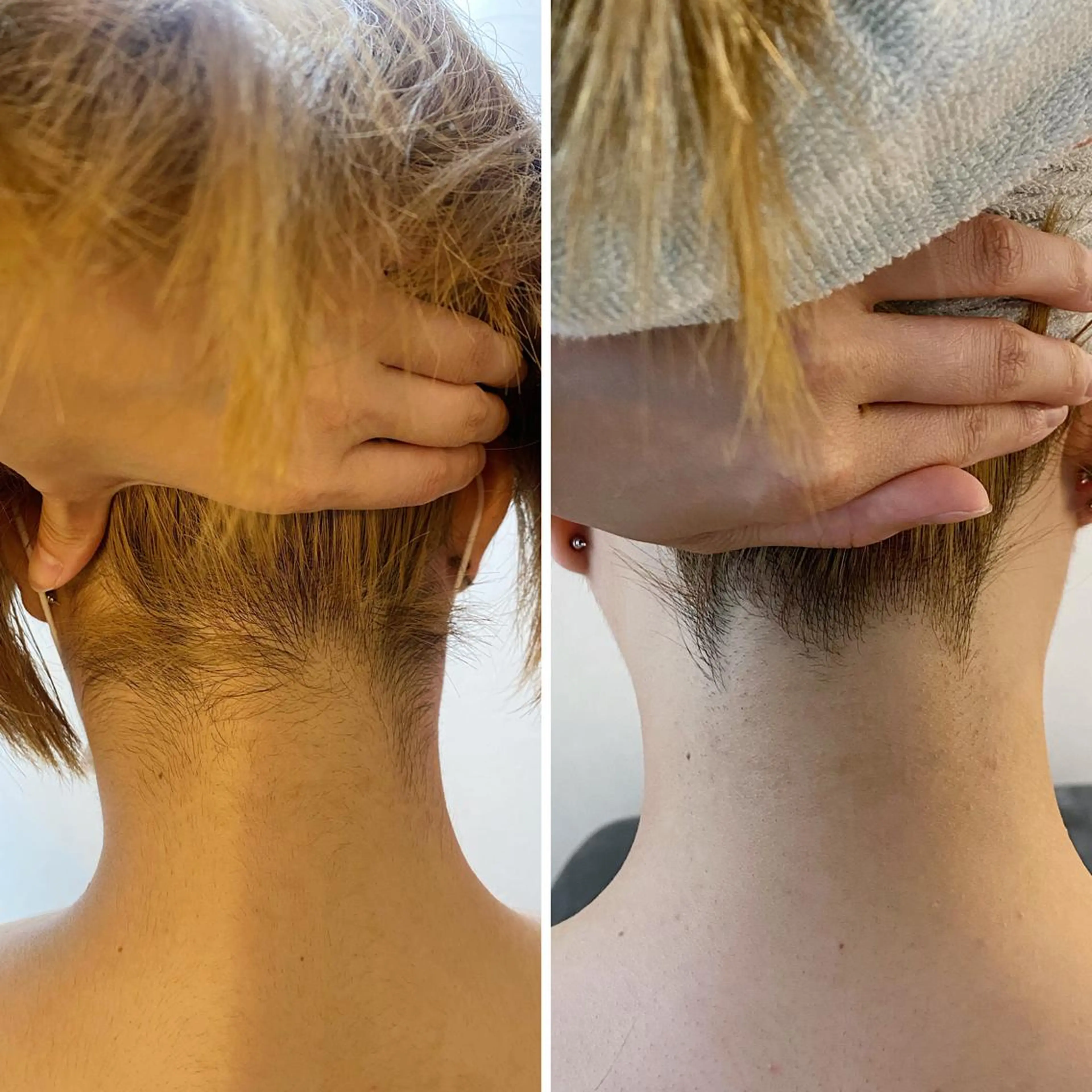 うなじ脱毛/美肌脱毛 LABELのエステ・リラクイメージ