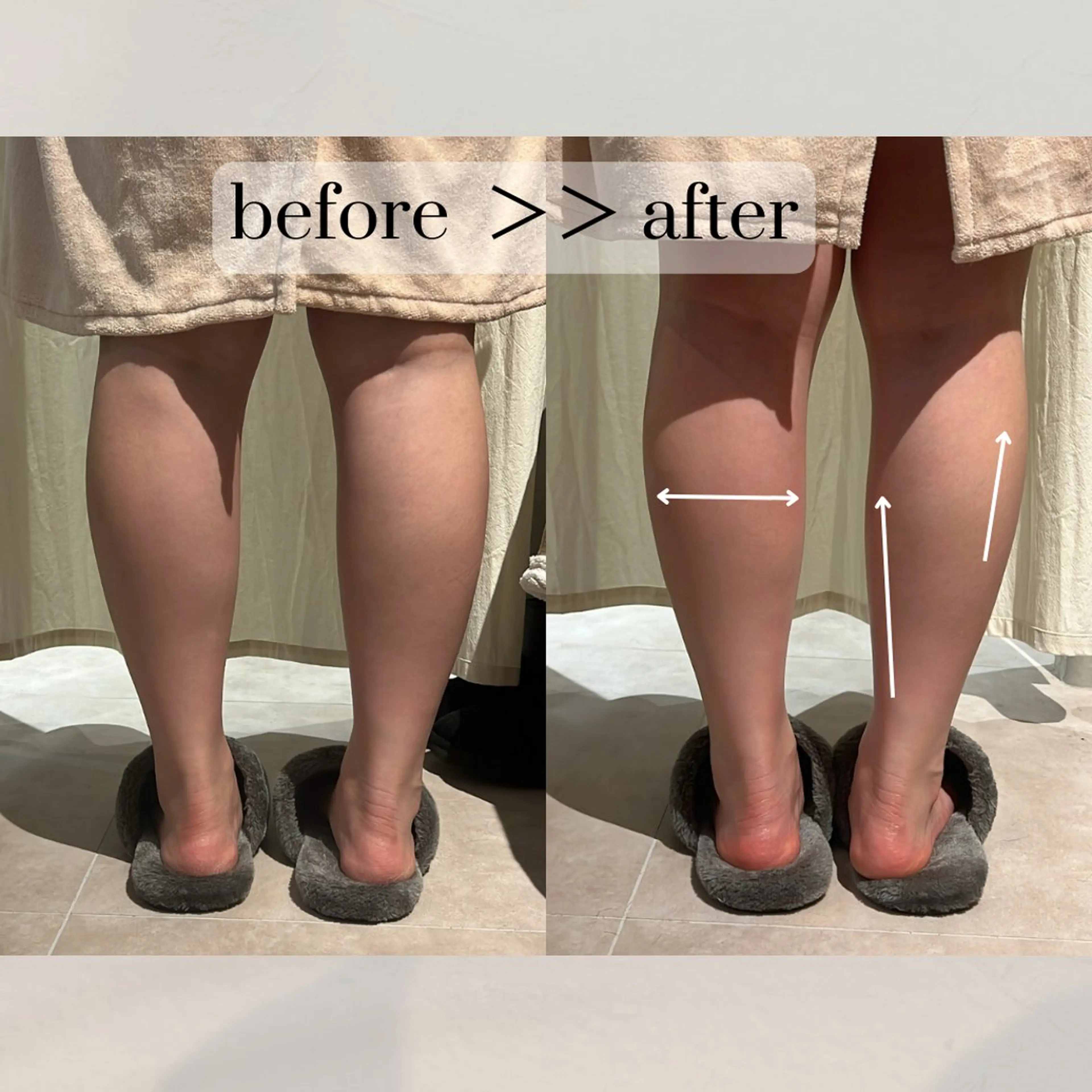 【vidyto】ヴィディトゥ所属・肌管理サロン vidyto　MOEのエステ・リラクイメージ