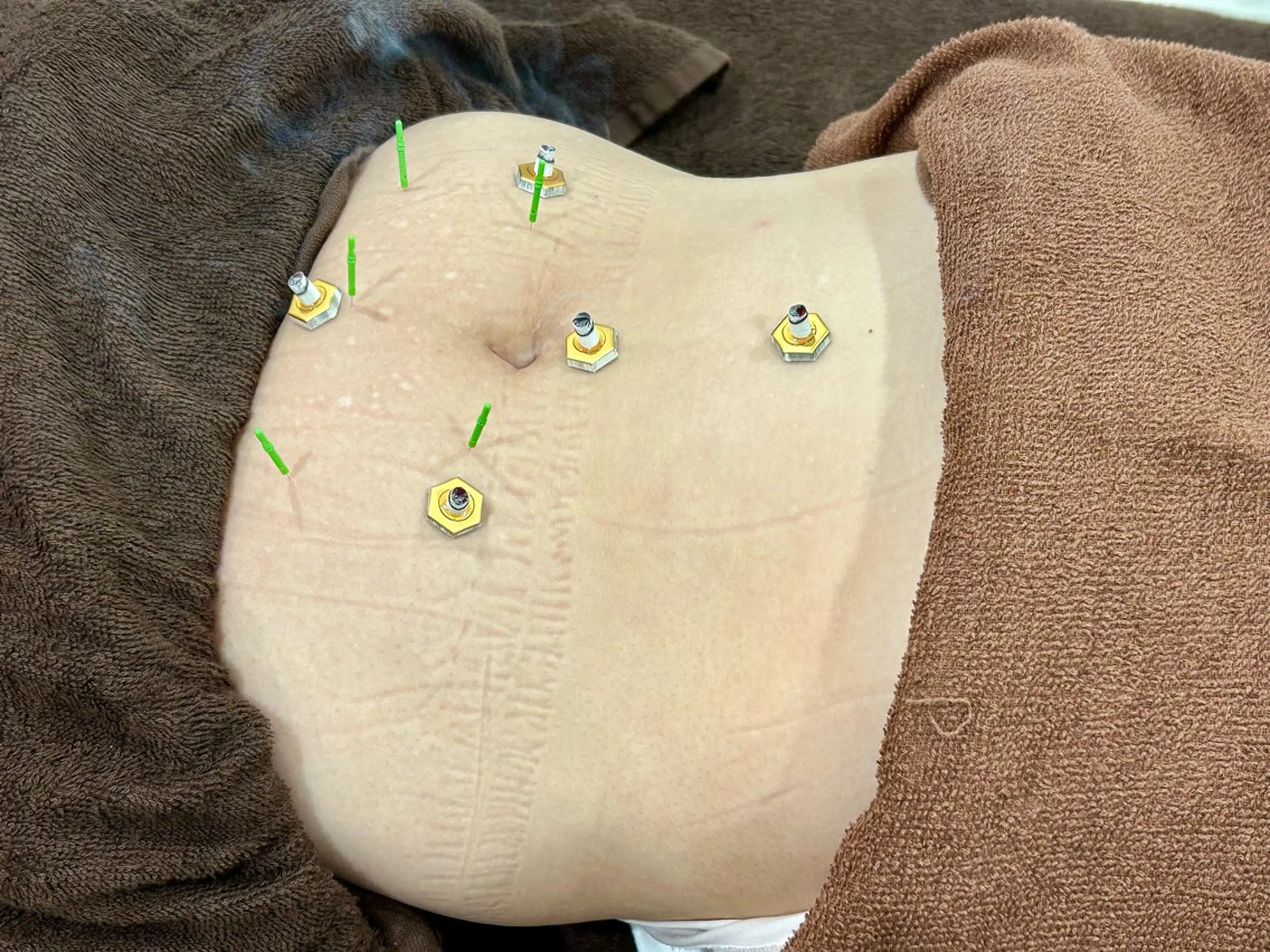 エステ リラク 鍼灸HARIKARA所属・辛島 昴のエステ・リラクイメージ