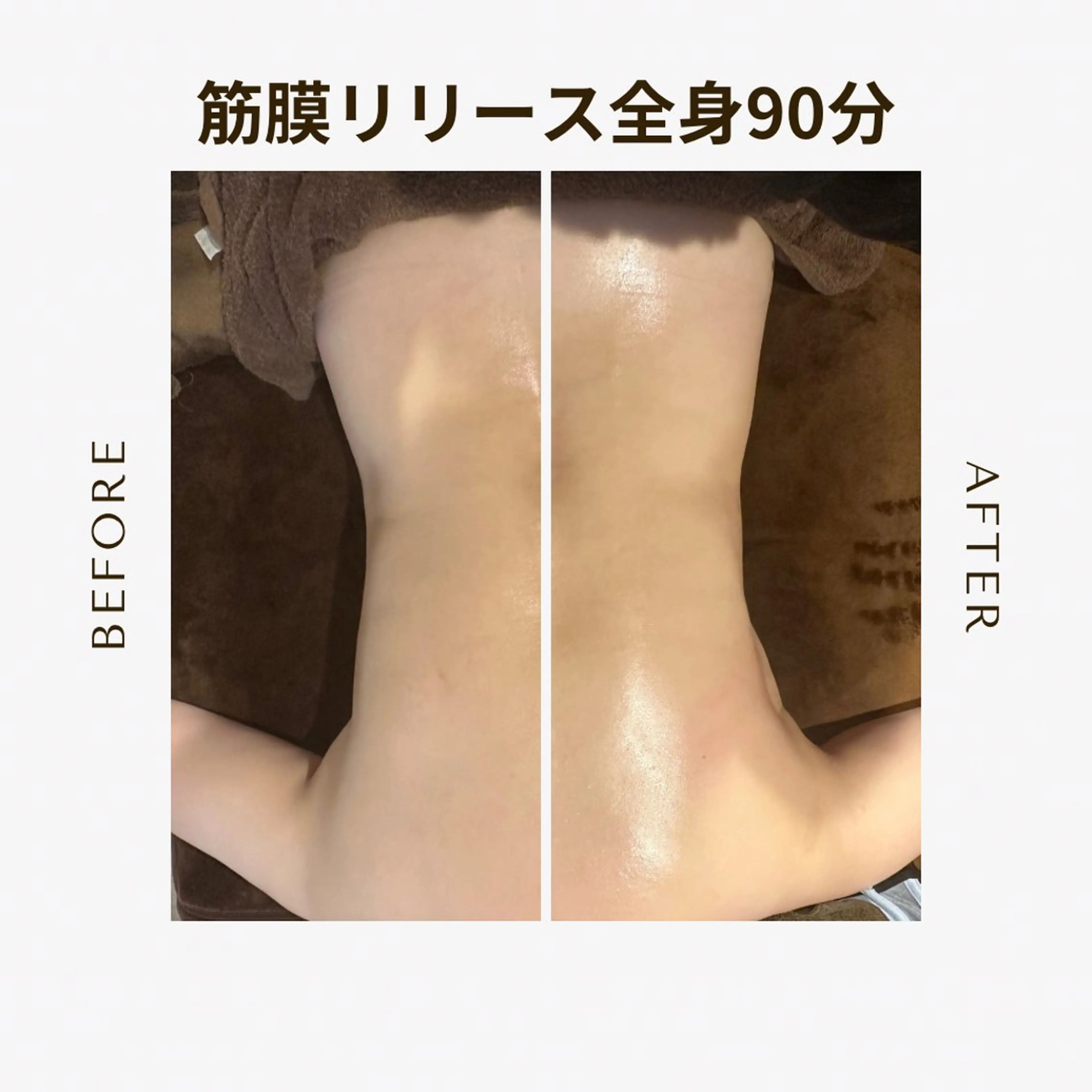 （痩身）全身筋膜リリース90分＋ドライヘッドスパの写真