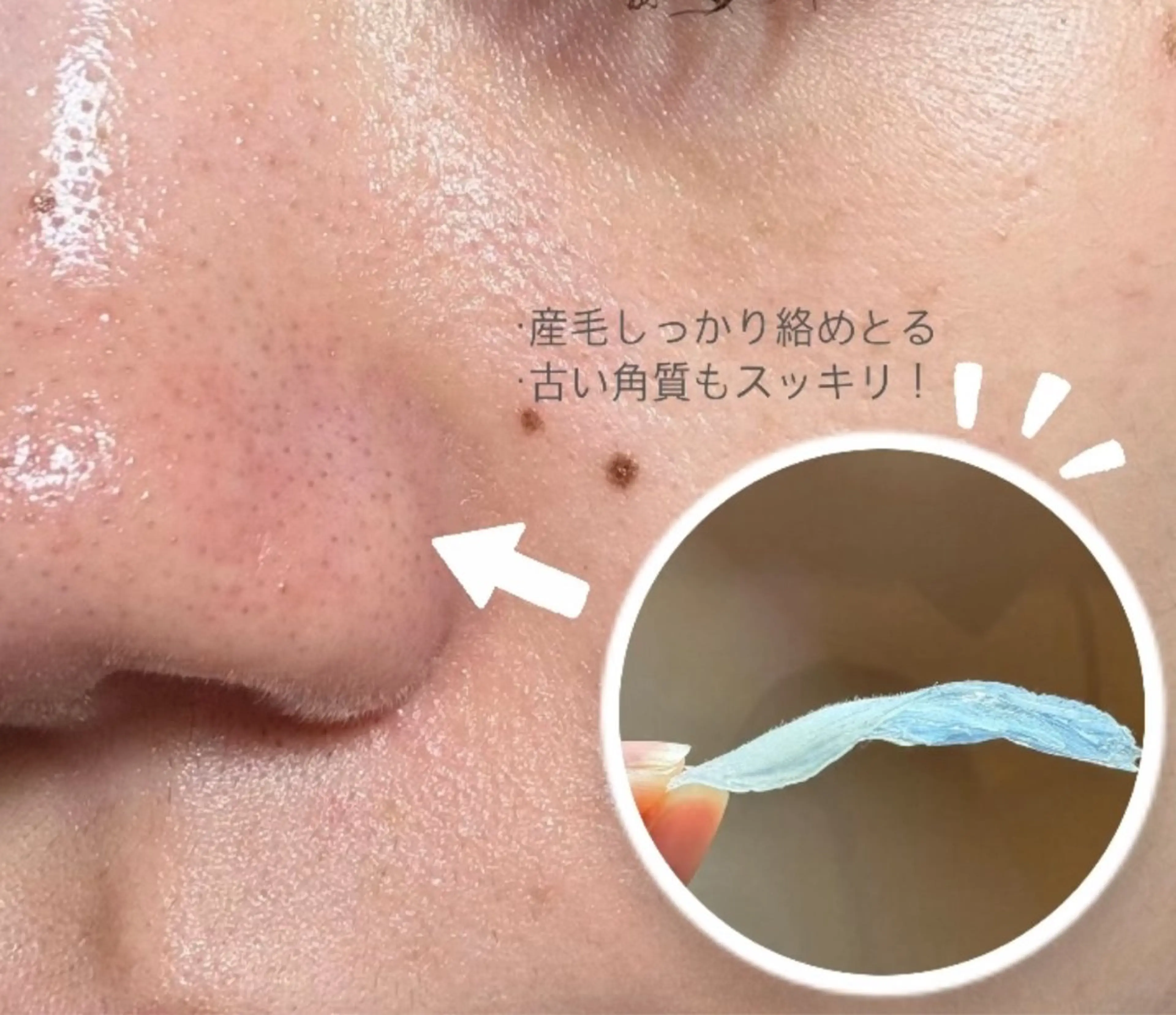 エピナス町田店 ブラジリアンワックスのエステ・リラクイメージ