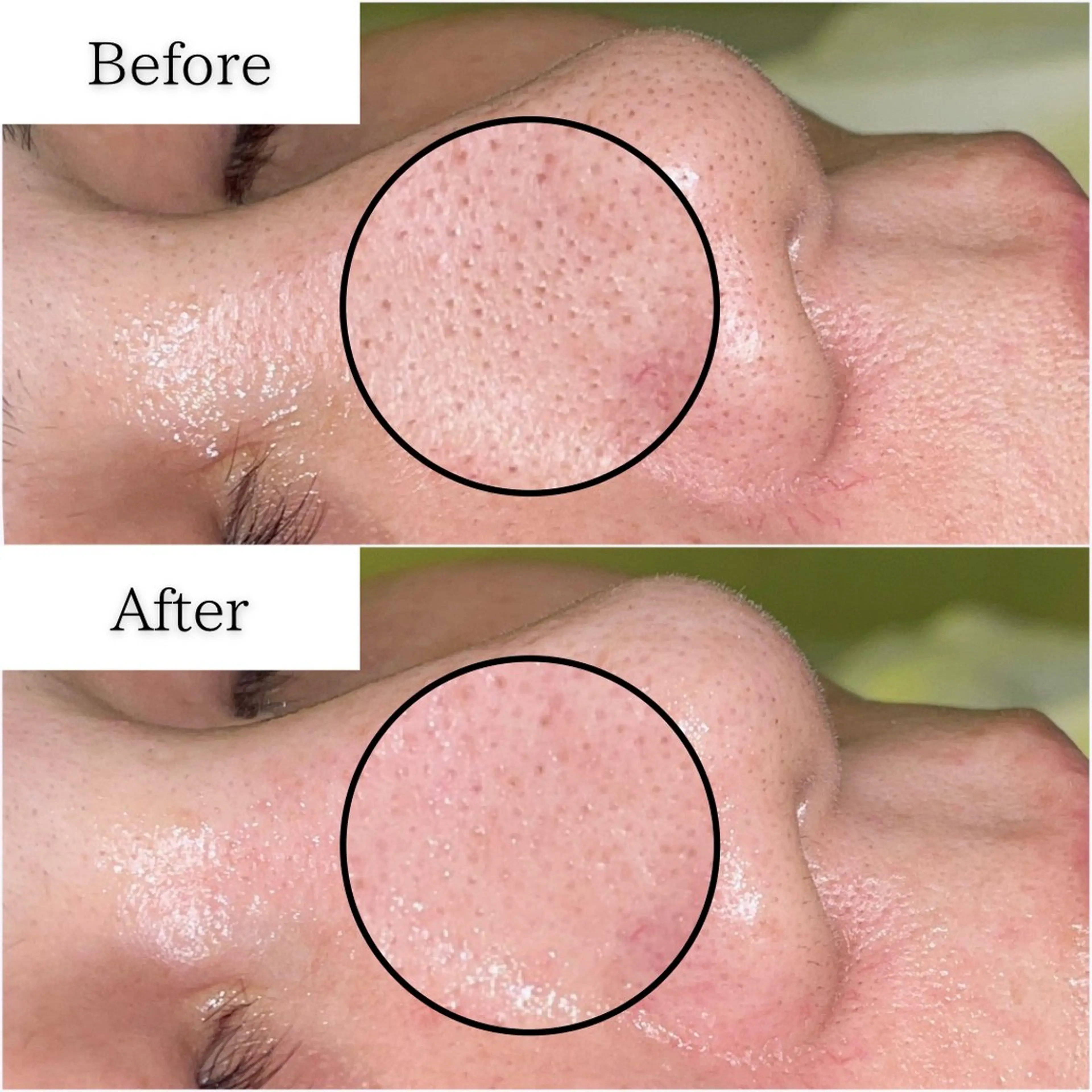 エステ SELF  BEAUTY gracia浦添店所属・gracia 浦添店のその他イメージ