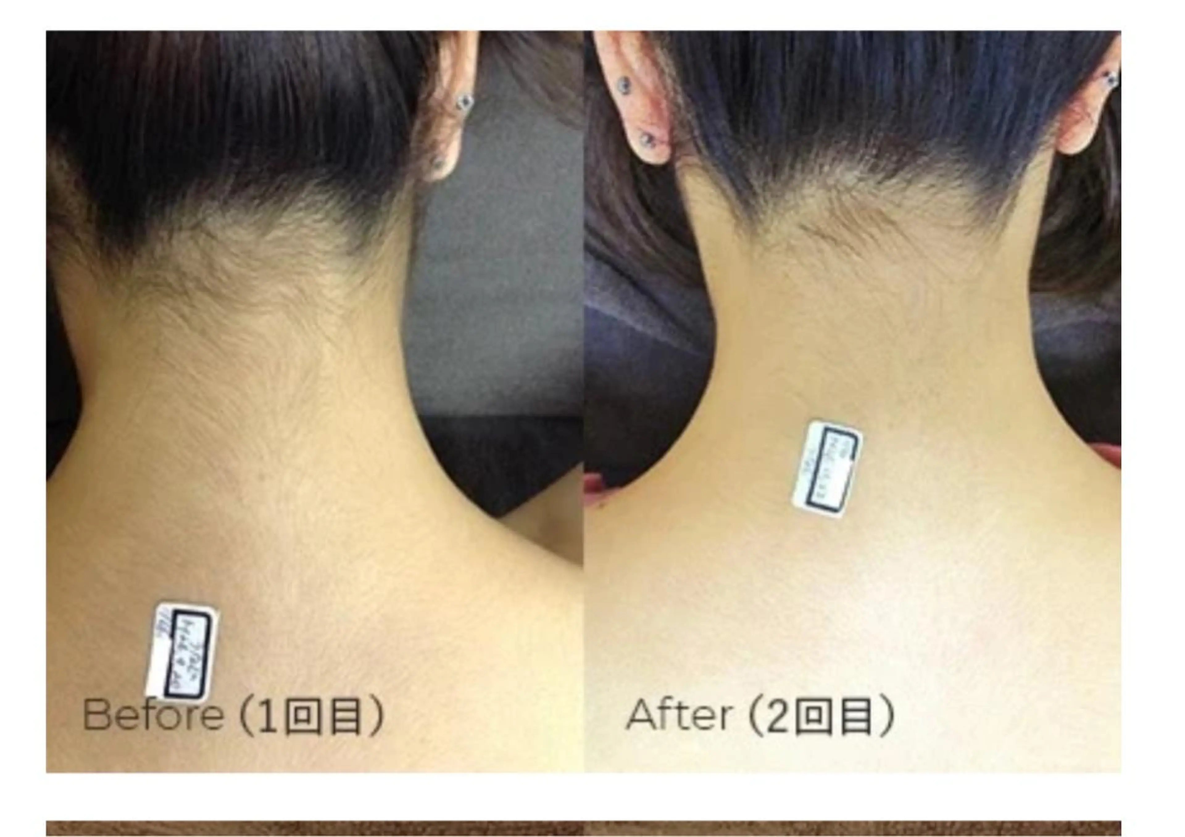 脱毛 meravi所属・MERAVI 🫧🌿のマツエク・マツパデザイン