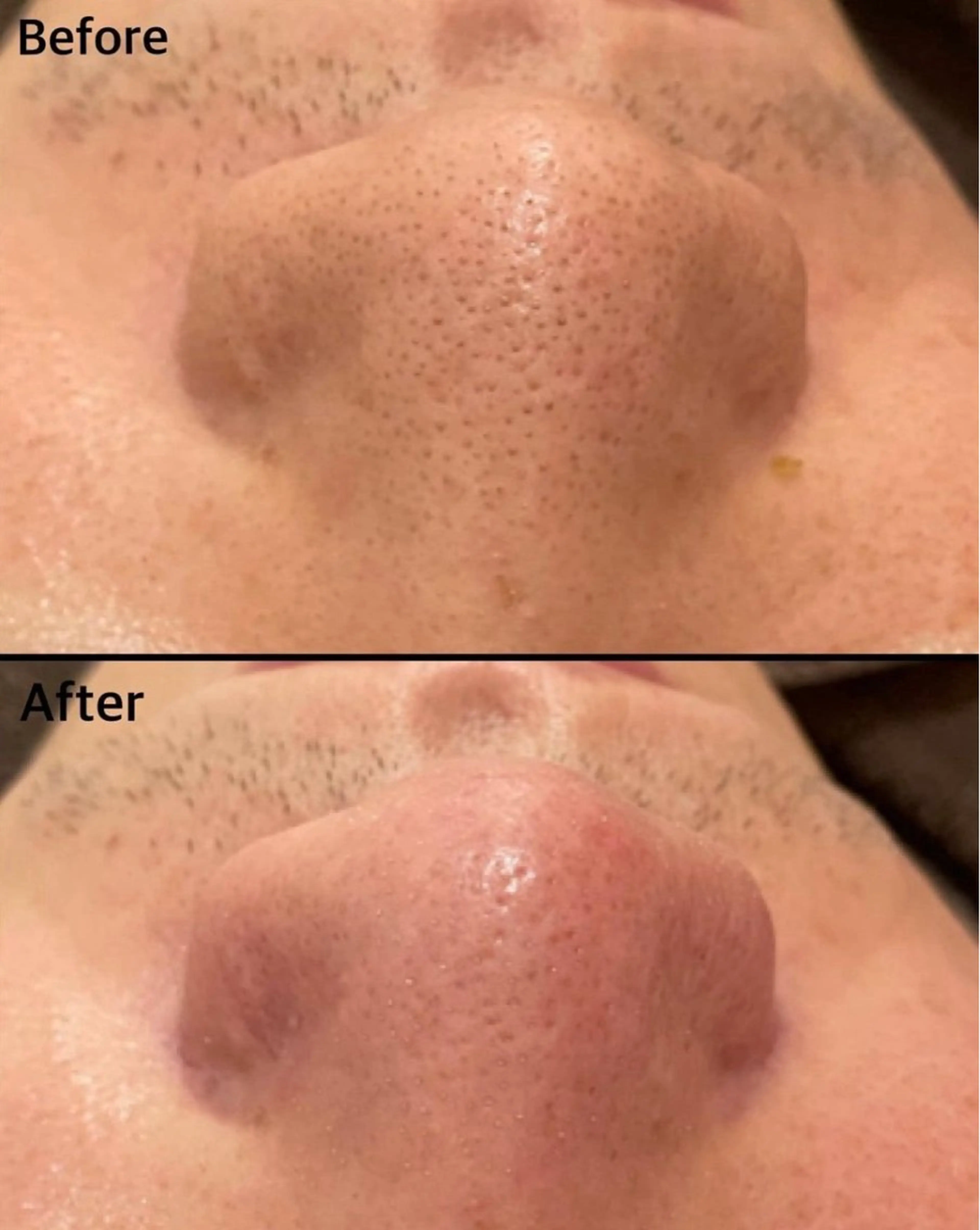 トータルビューティーサロンFirstclass所属・Firstclass Erikaのエステ・リラクイメージ