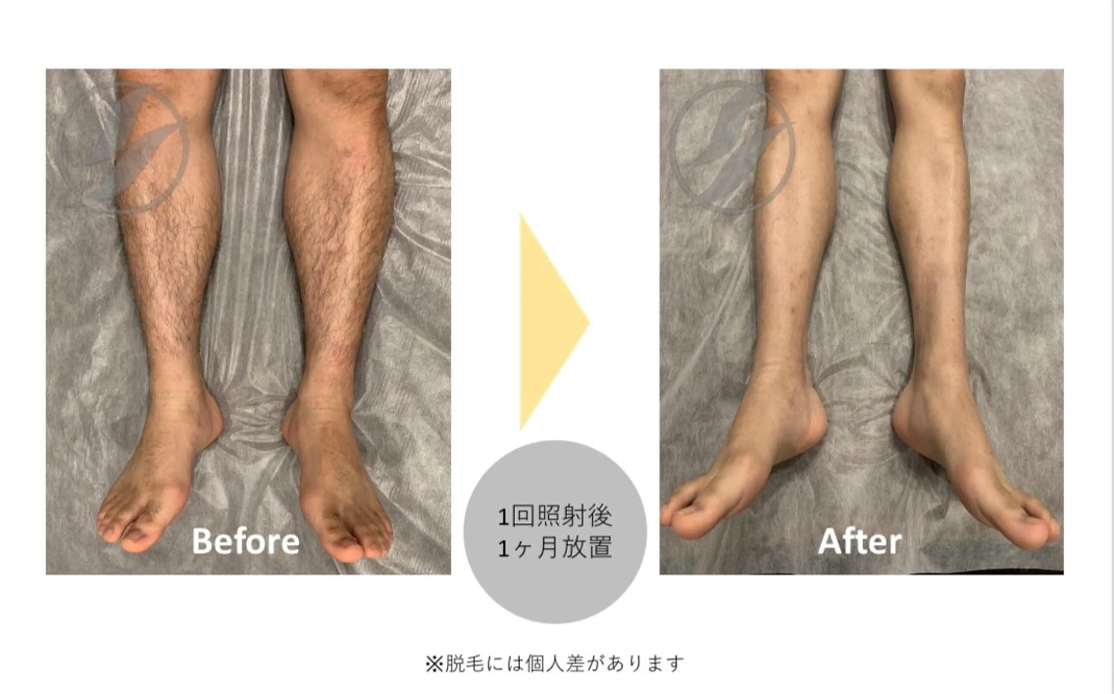 HARUHARU所属・HARU HARU Motoのマツエク・マツパデザイン