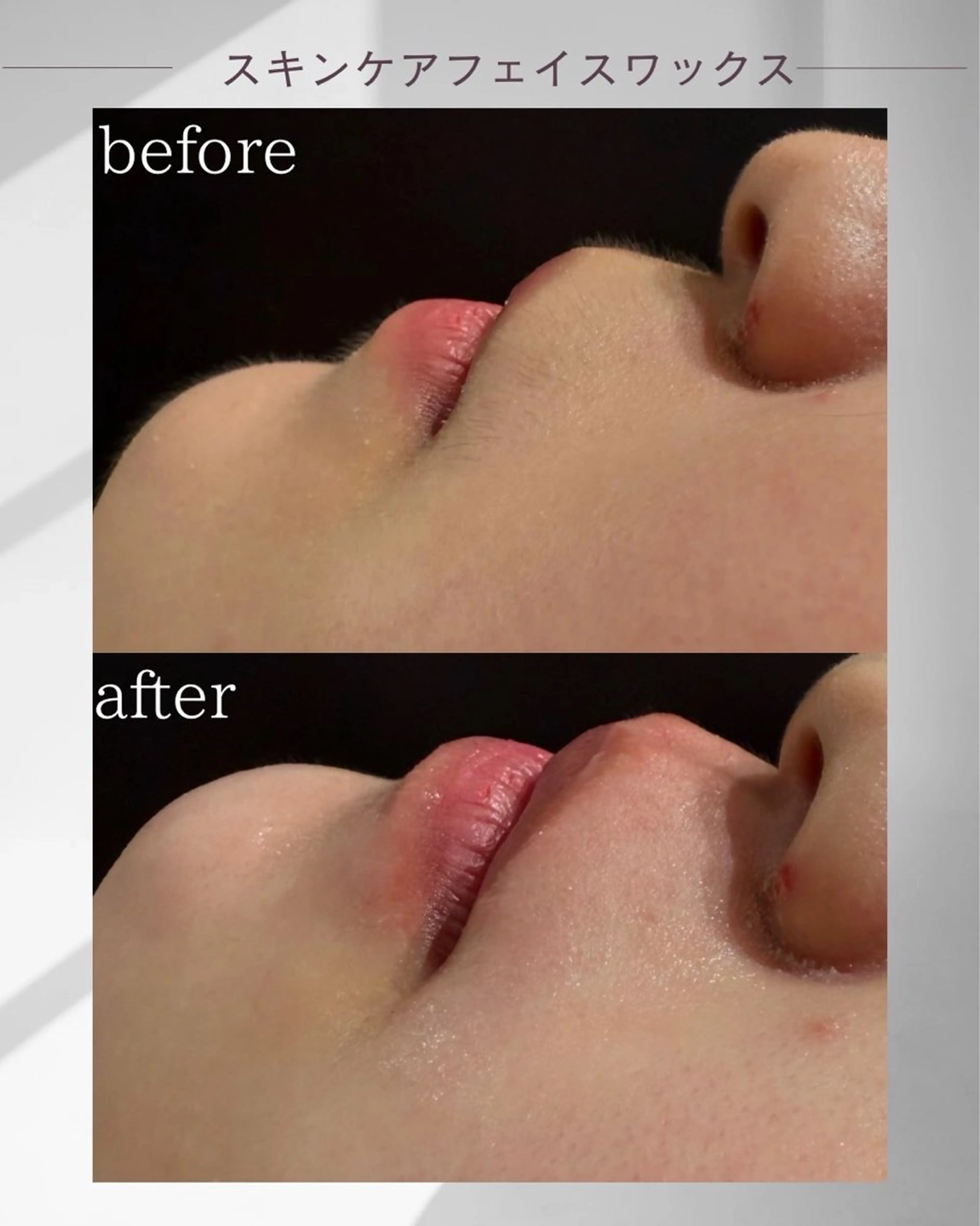 スキンケアフェイスワックスの写真