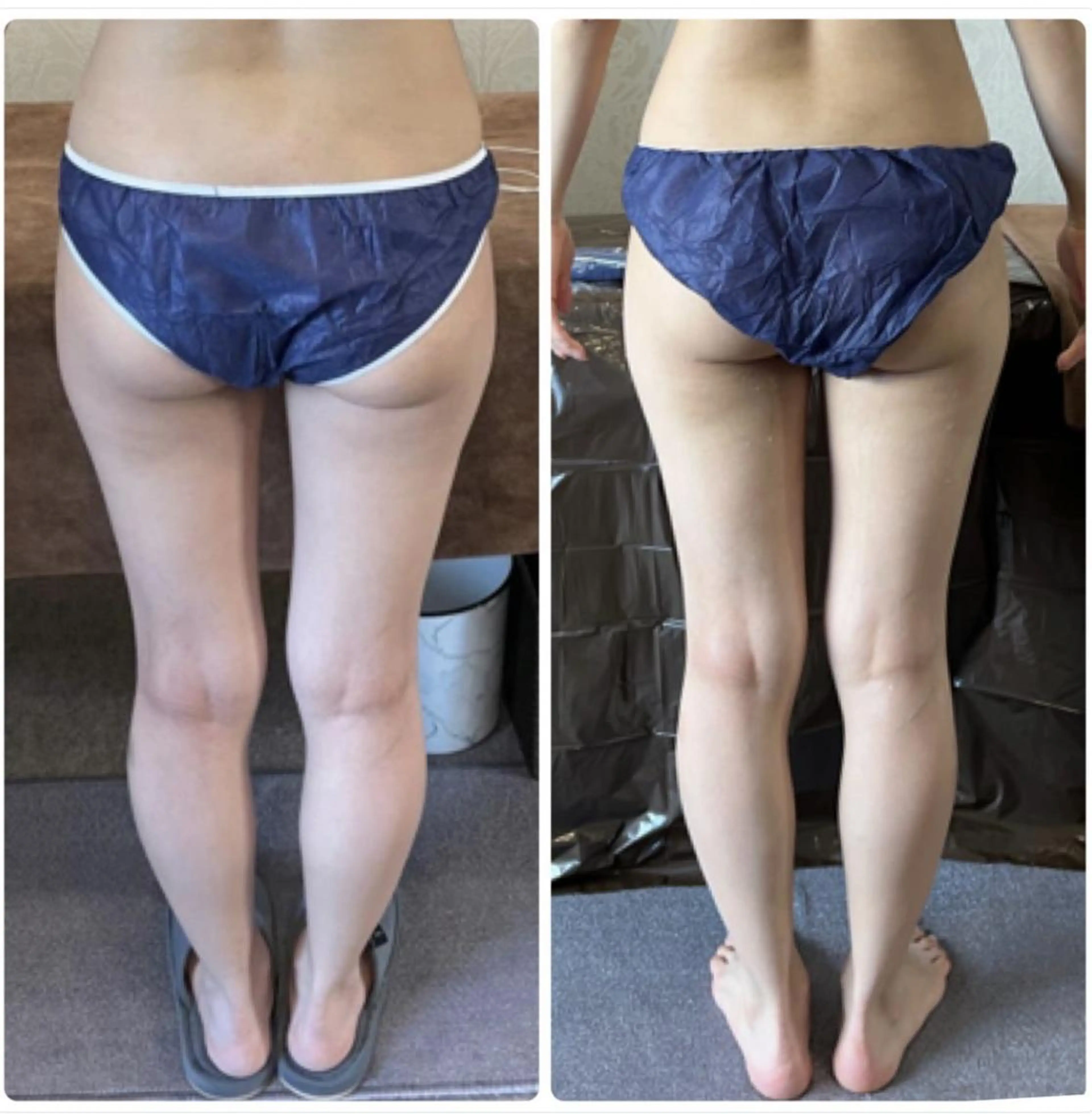 FLEUR大阪・美容 整体・痩身・小顔のエステ・リラクイメージ