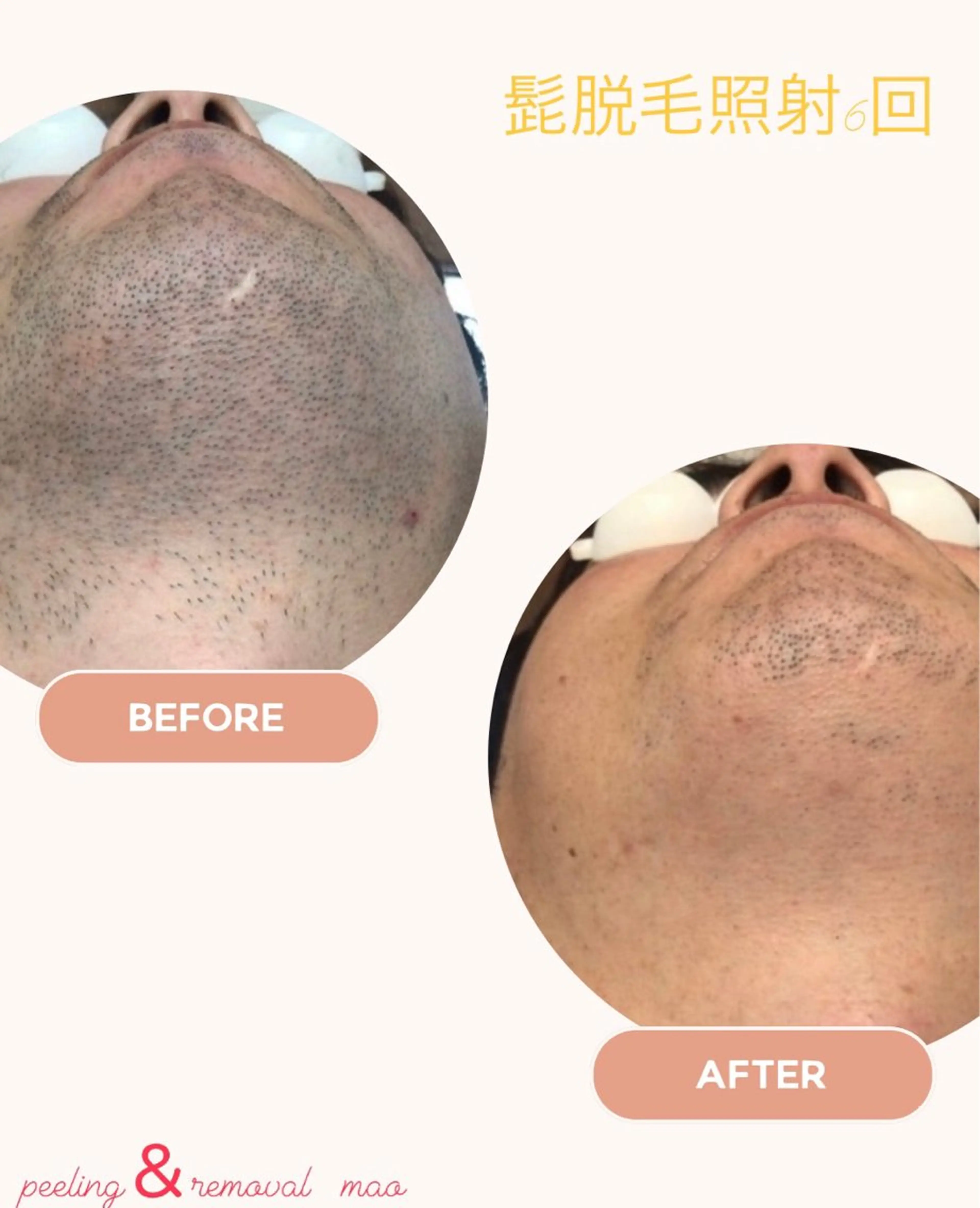 ピーリング＆脱毛 maoのエステ・リラクイメージ