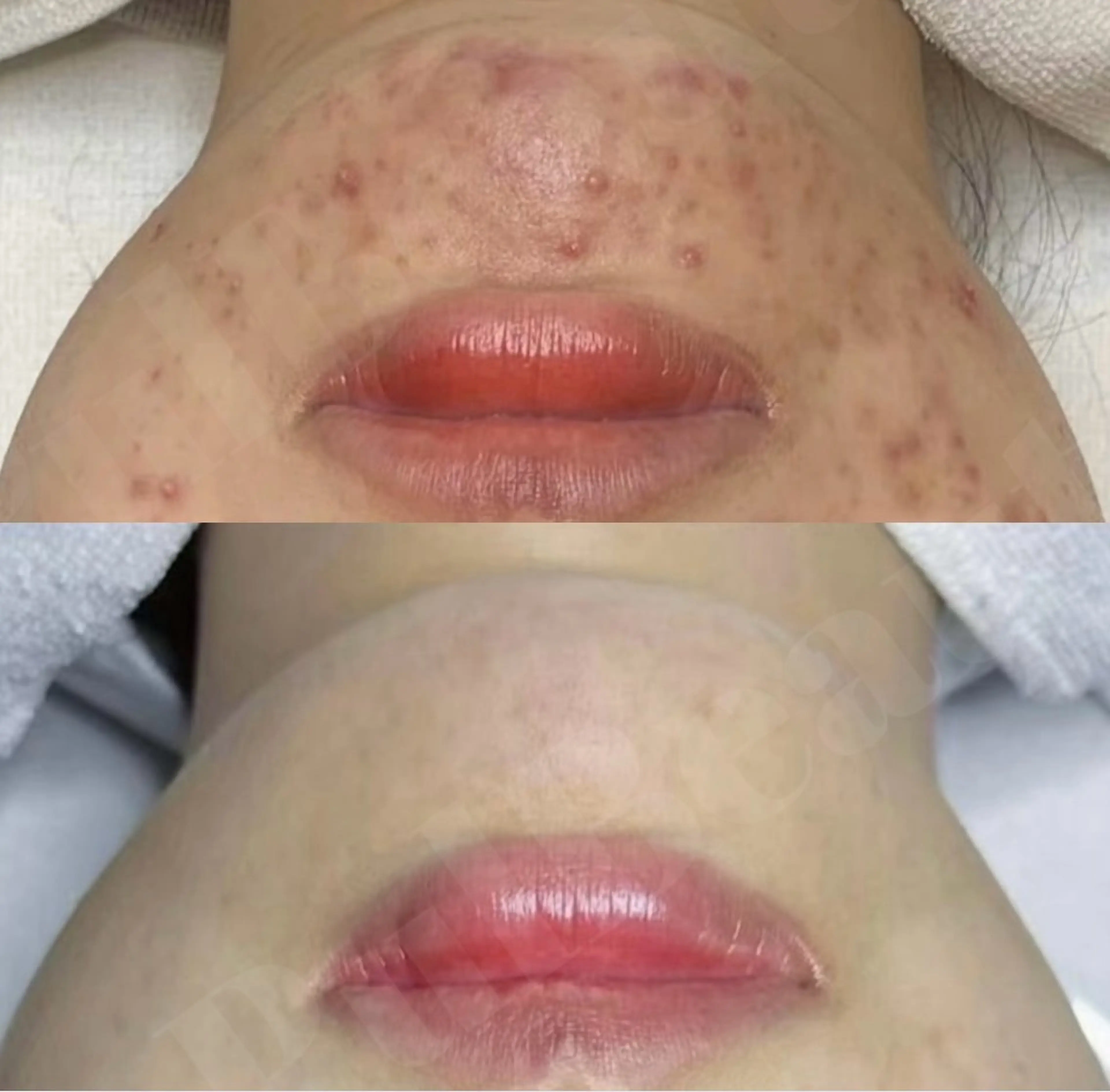 【新宿】 PulBeauteのエステ・リラクイメージ