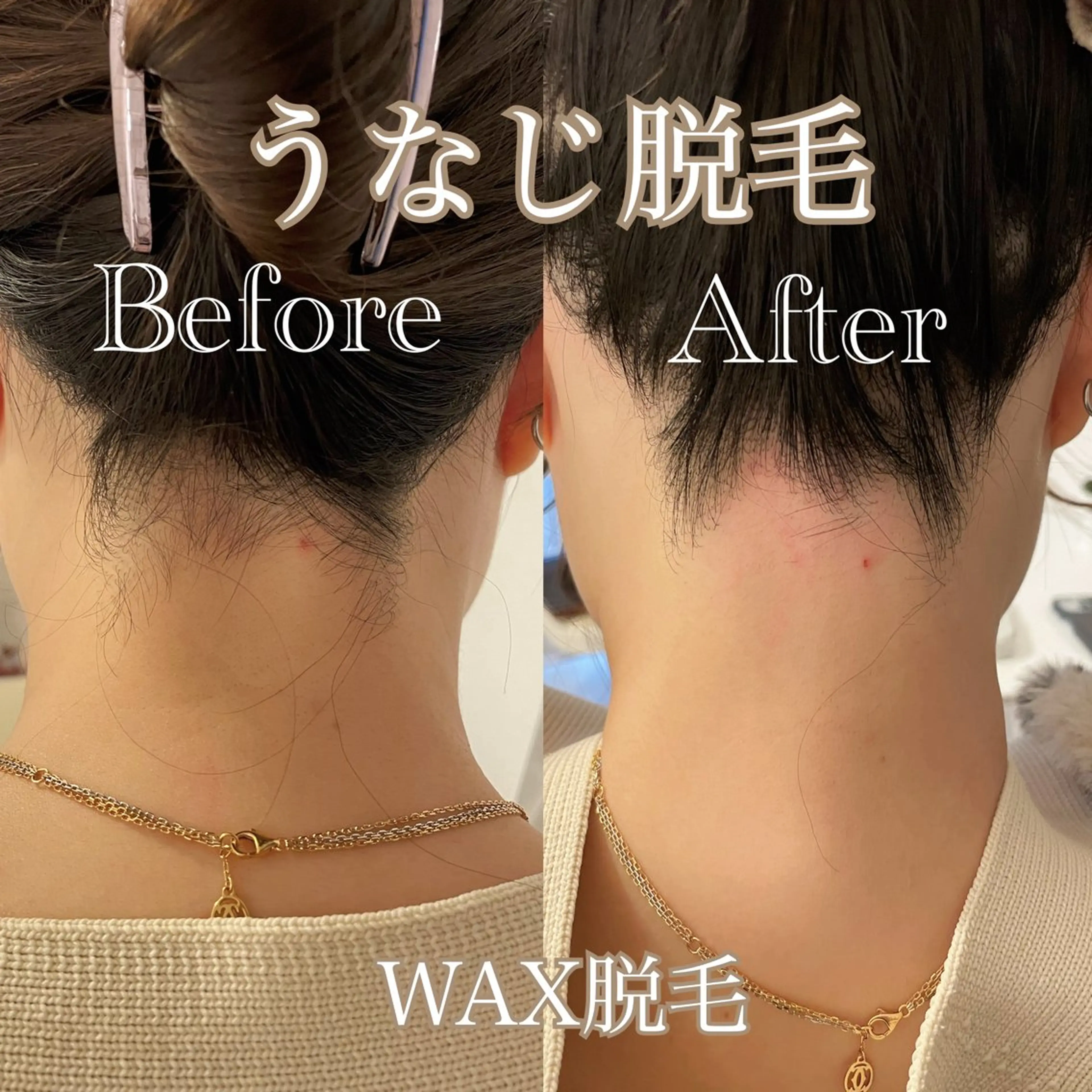 【先着5名】ワックス脱毛モニター価格✨990円の写真