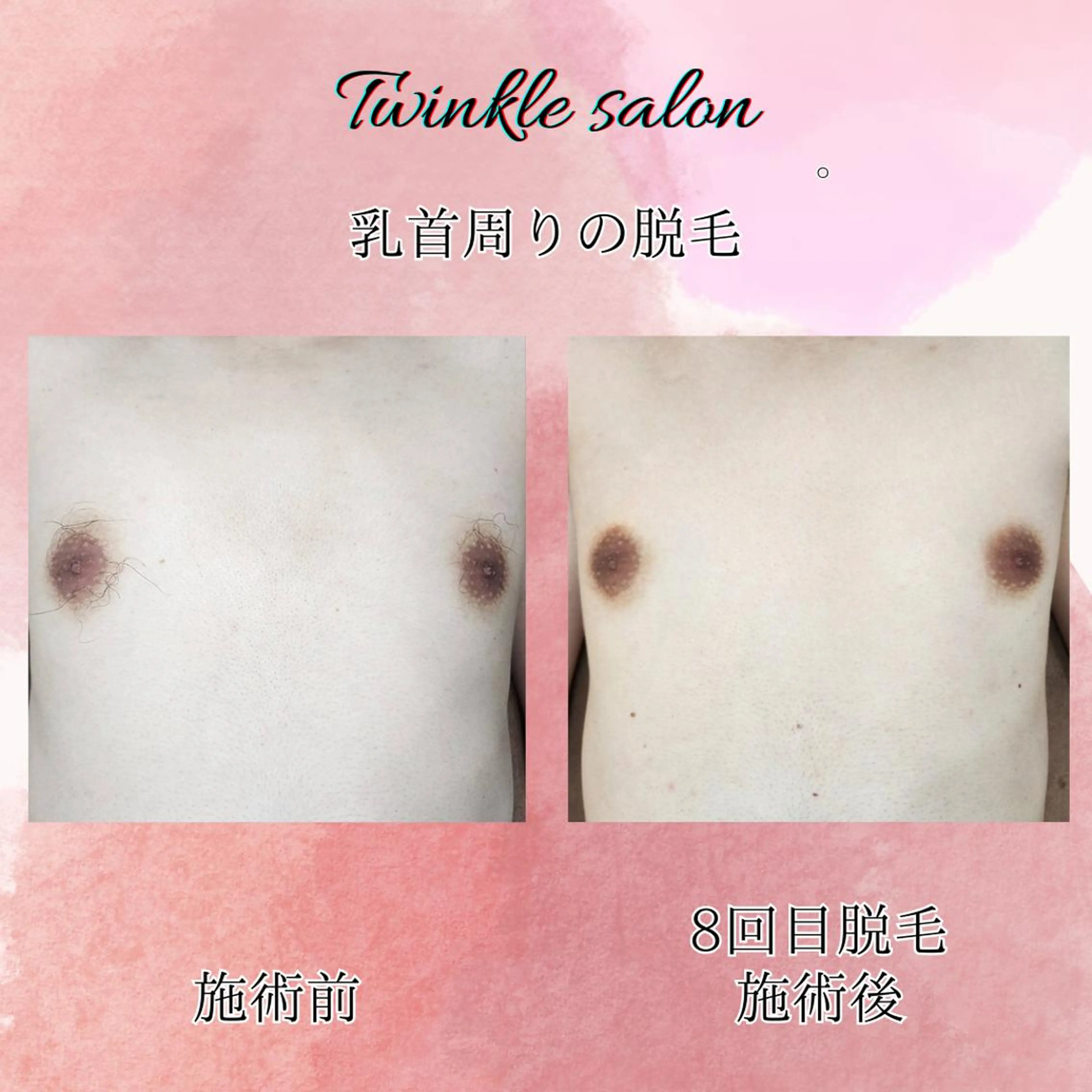 メンズ 脱毛 中井 光明の眉毛・アイブロウイメージ