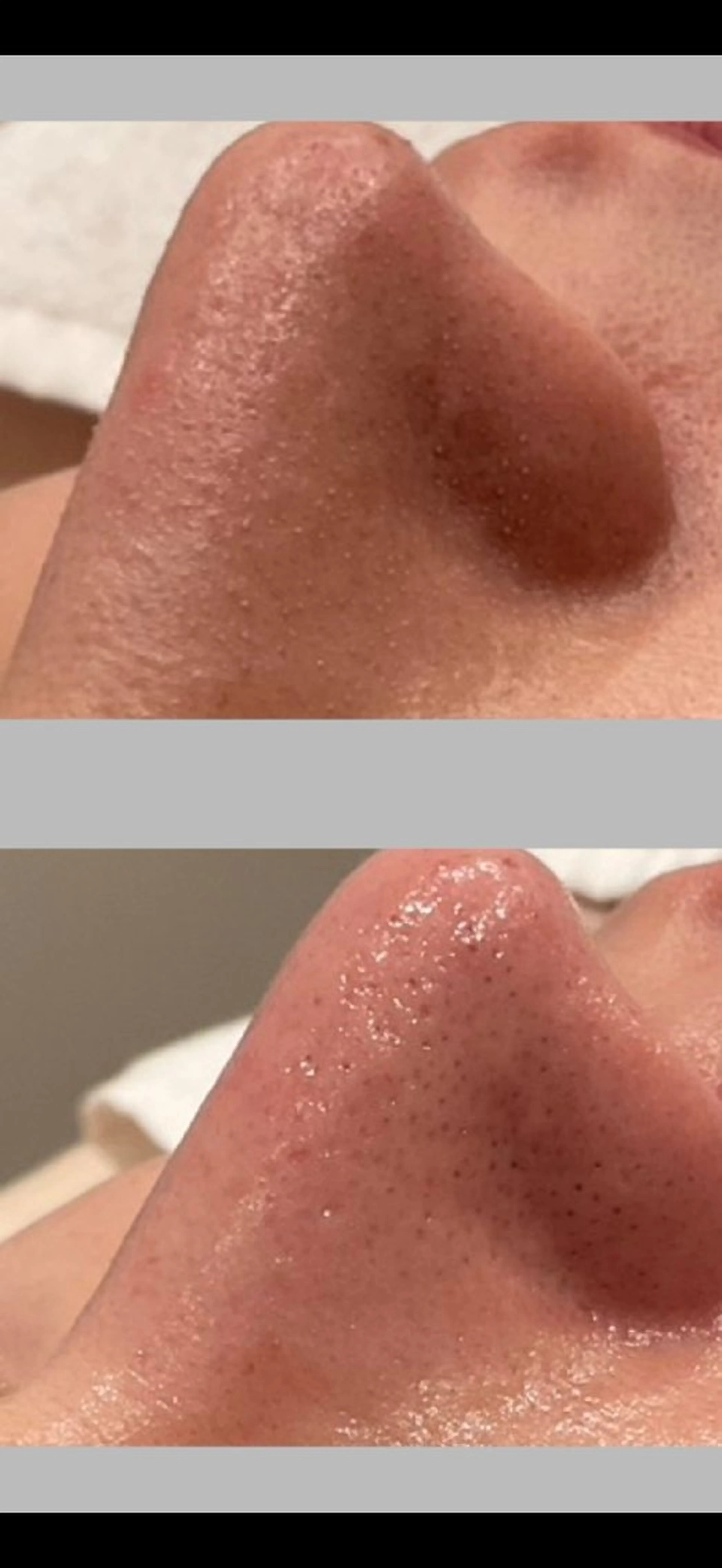 エステ ベル チェリカ 三城のエステ・リラクイメージ