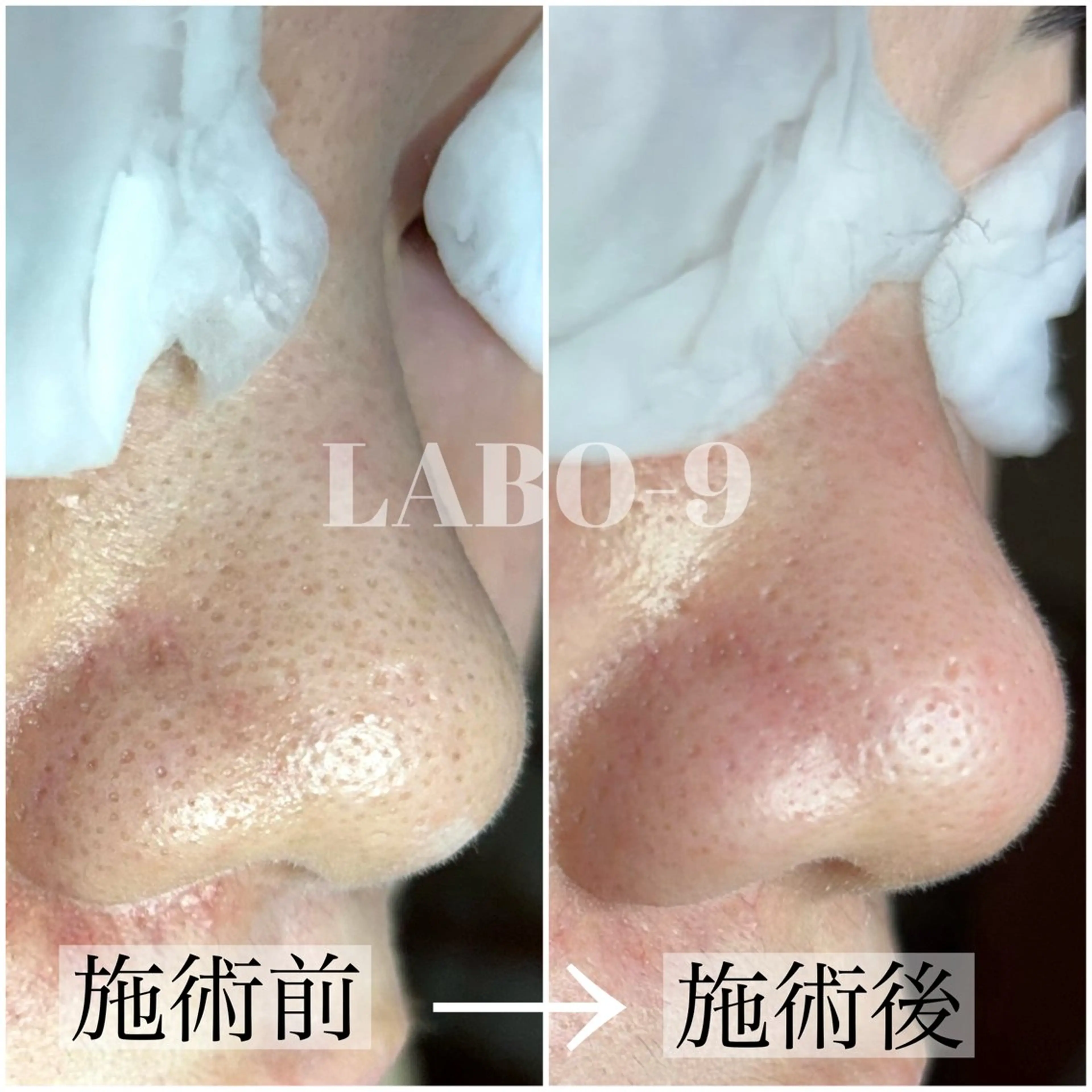 LABO-9所属・田中 捺未のエステ・リラクイメージ