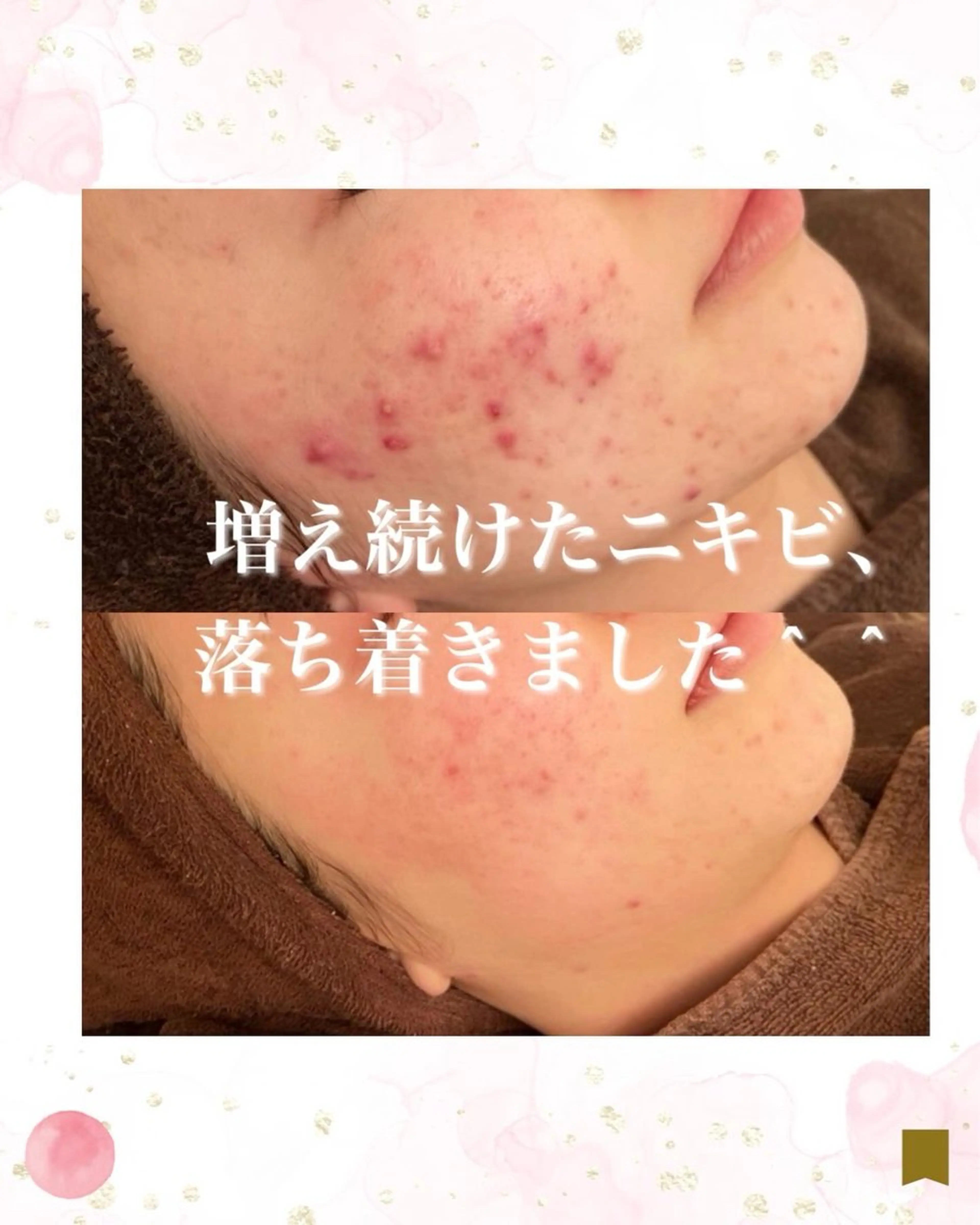 エステ リラク ニキビ跡専門サロン Ainaのエステ・リラクイメージ