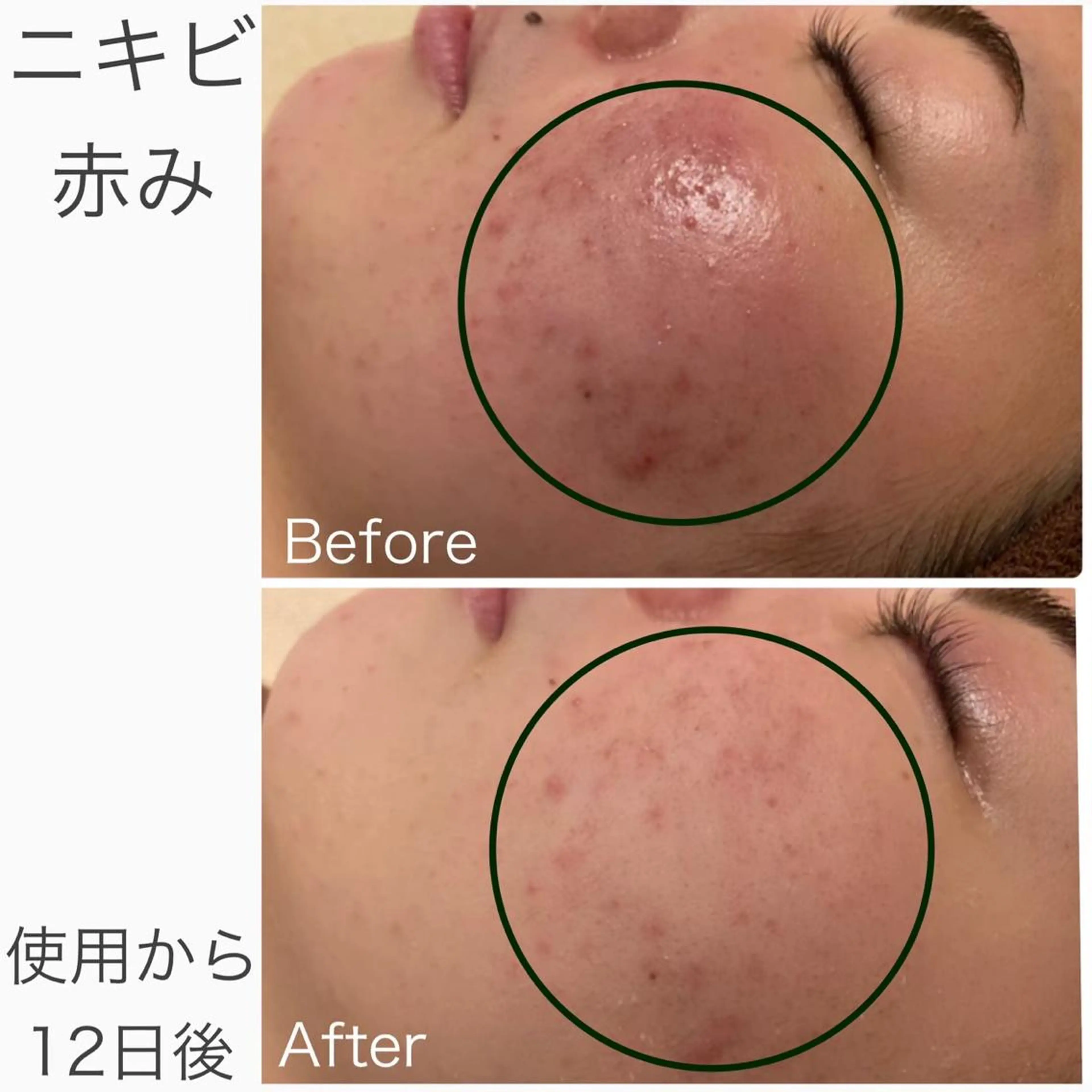 ショート カラー パーマ ヘアアレンジ メンズ キッズ ネイル マツエク・マツパ アイブロウ ニキビ特化型エステ 🍓最短で肌質改善のエステ・リラクイメージ