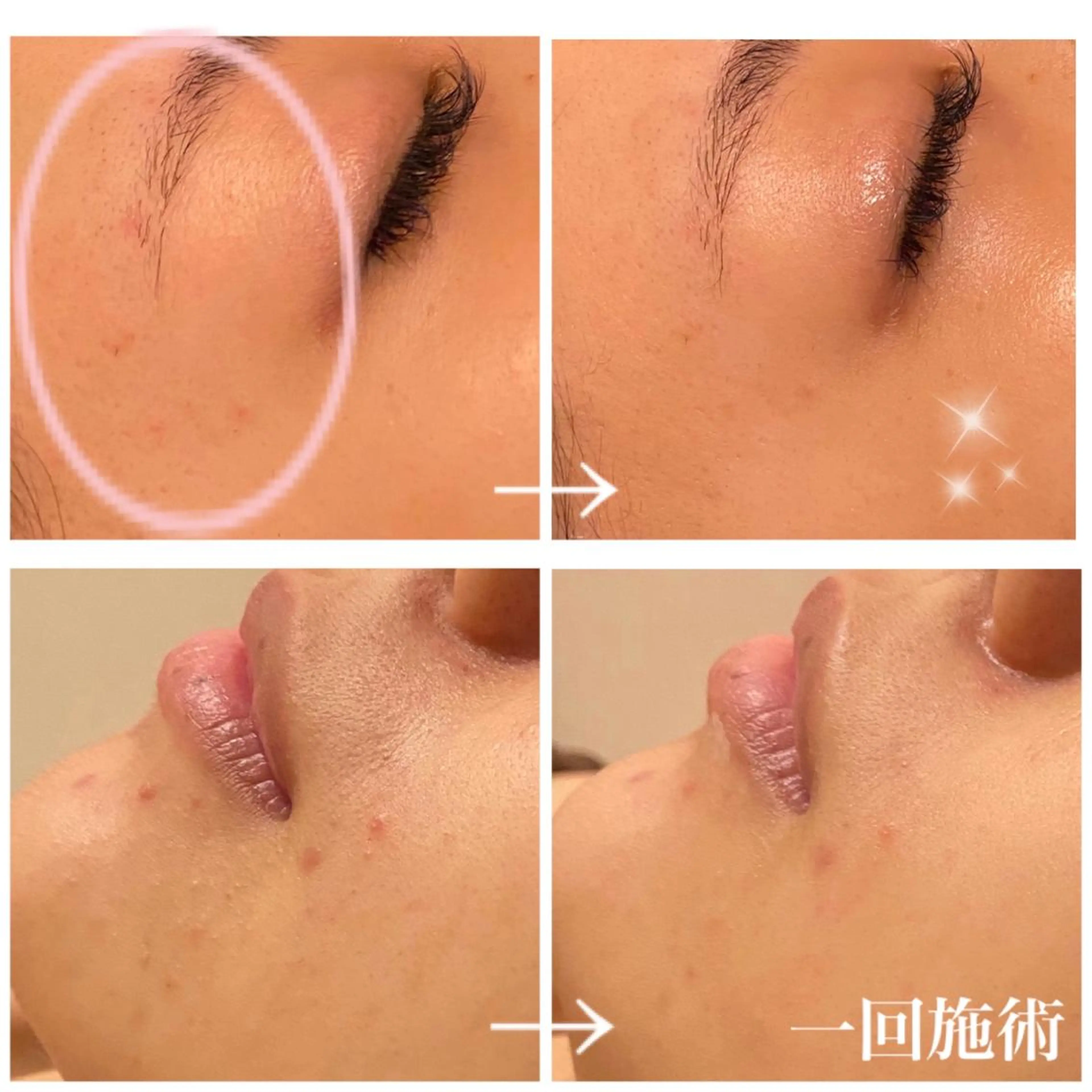 エステ リラク ダイエット・美肌ケア fleurのエステ・リラクイメージ