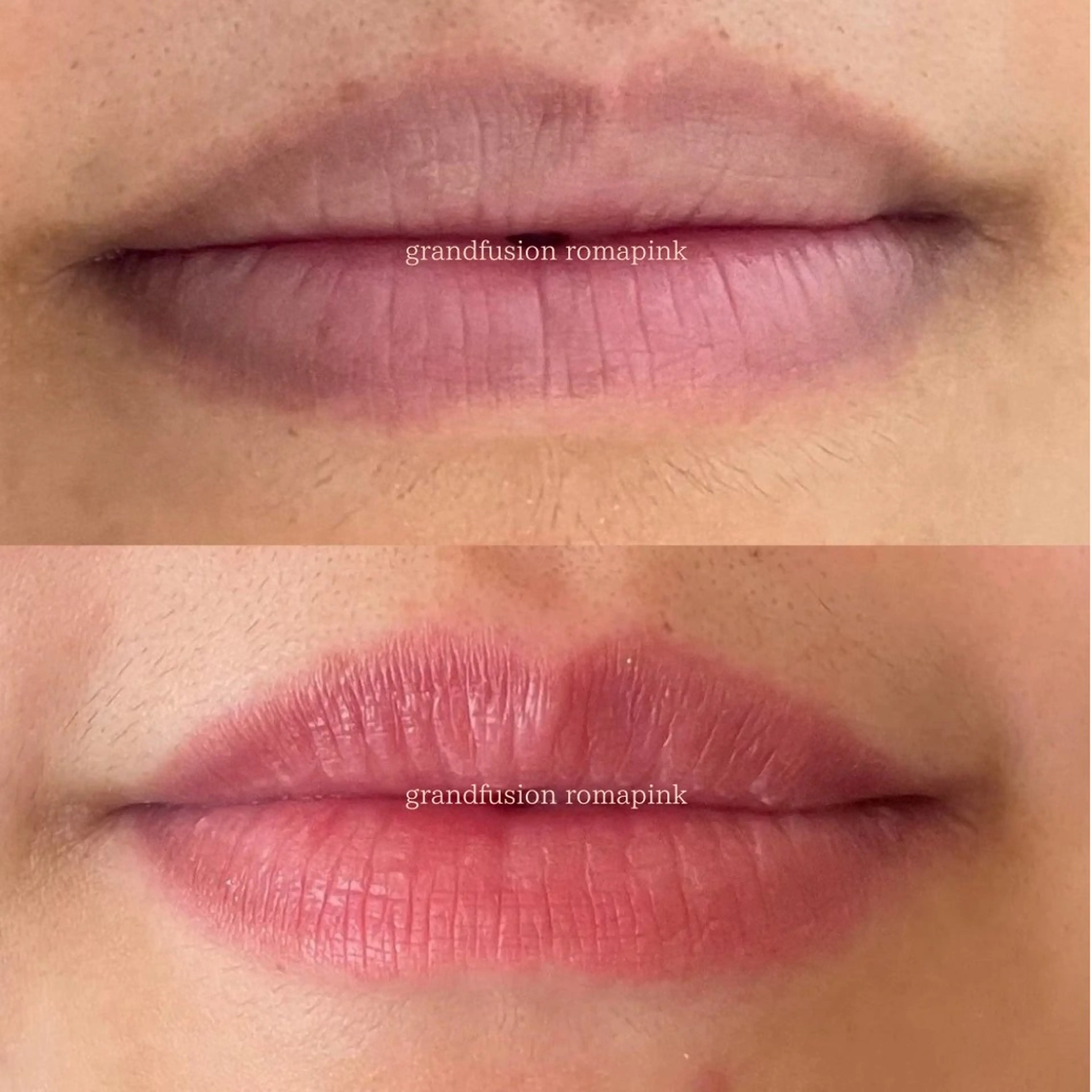 エステ Richeri 代官山のエステ・リラクイメージ